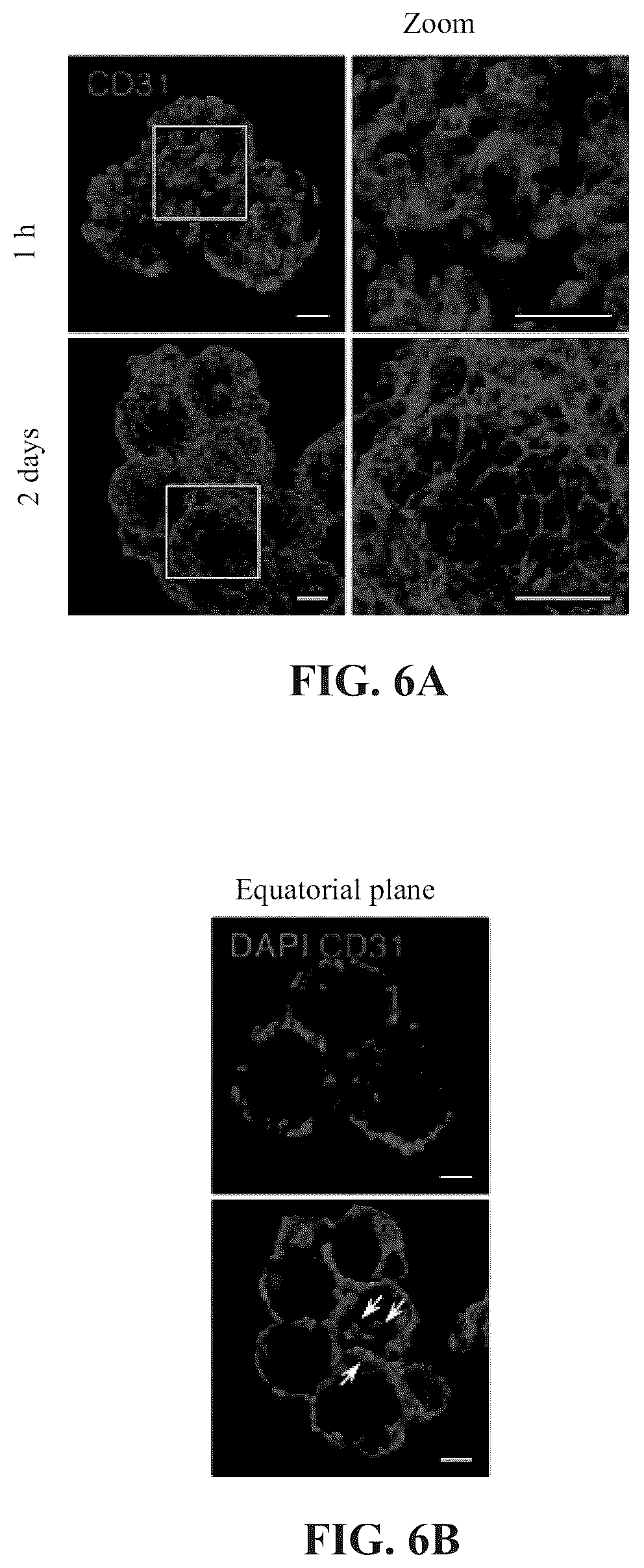 Patent US12097303 Figure 12 – Decellularized extracellular matrix, preparation process and uses thereof