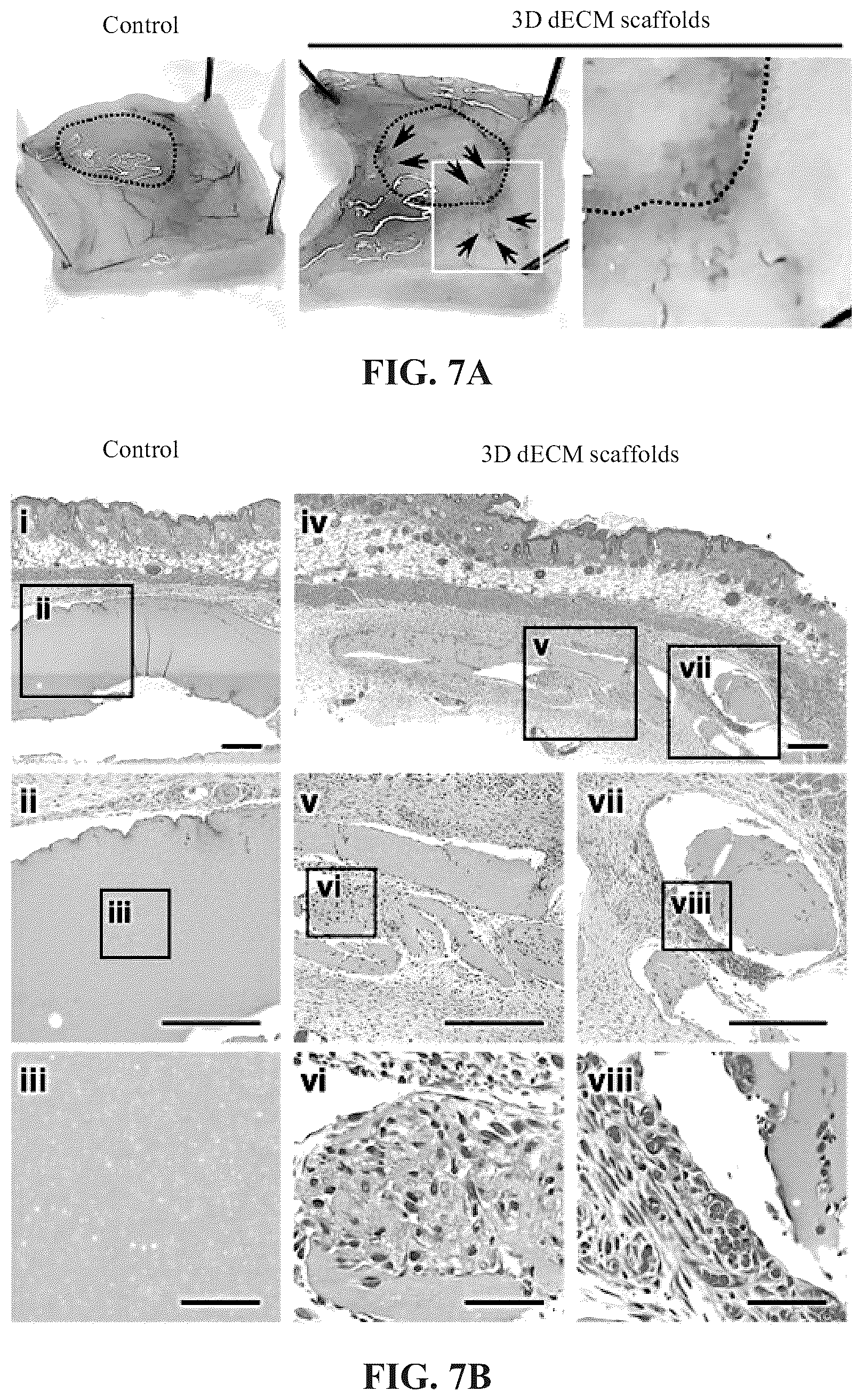 Patent US12097303 Figure 14 – Decellularized extracellular matrix, preparation process and uses thereof