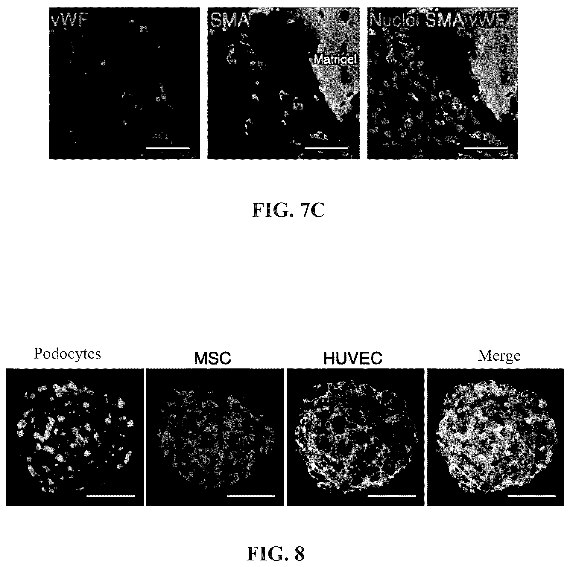 Patent US12097303 Figure 15 – Decellularized extracellular matrix, preparation process and uses thereof