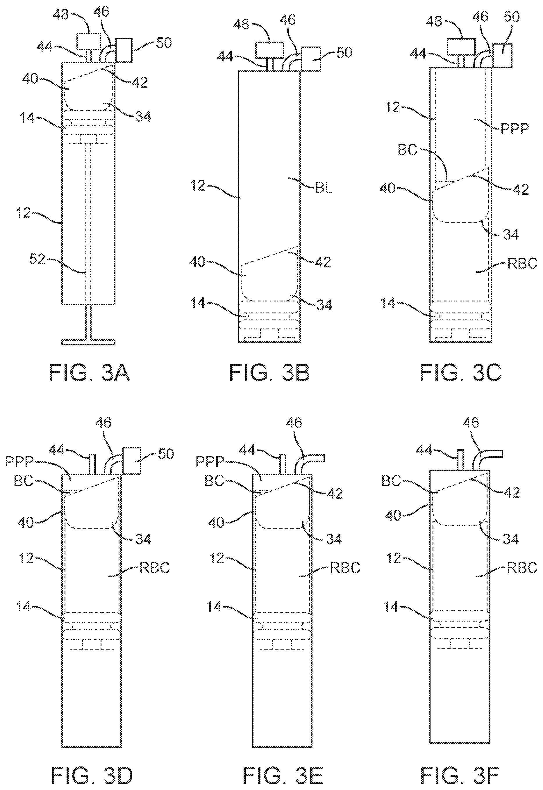 Patent US12097311 Figure 3 – Apparatus and methods for concentrating platelet-rich plasma