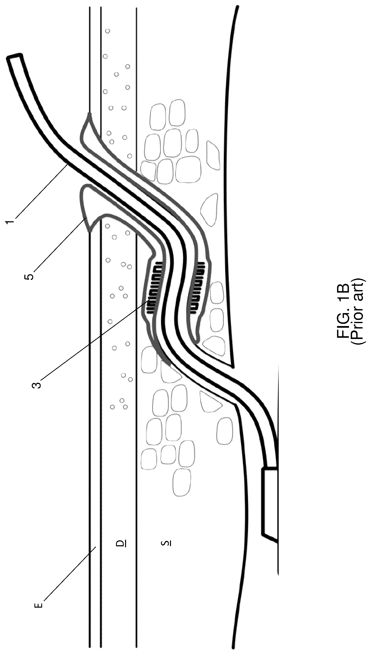 Patent US12097314 Figure 2 – Vacuum assisted skin penetrating appliance with external interface