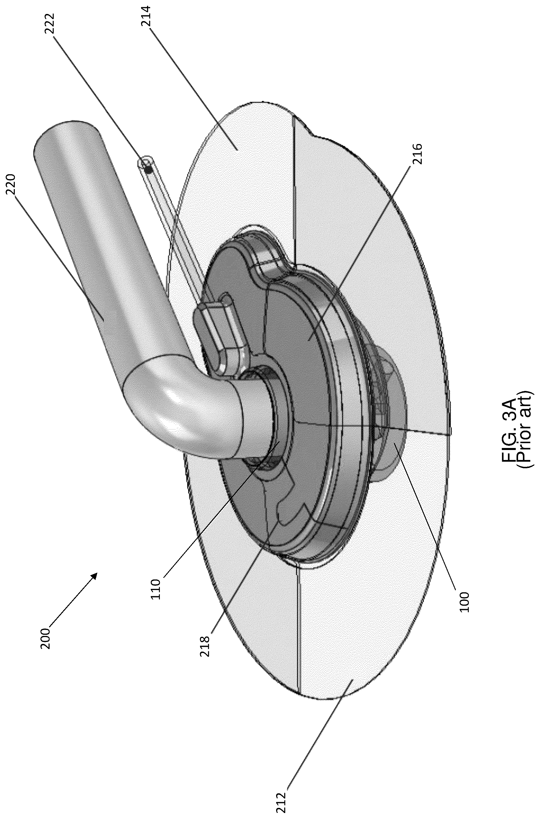 Patent US12097314 Figure 4 – Vacuum assisted skin penetrating appliance with external interface