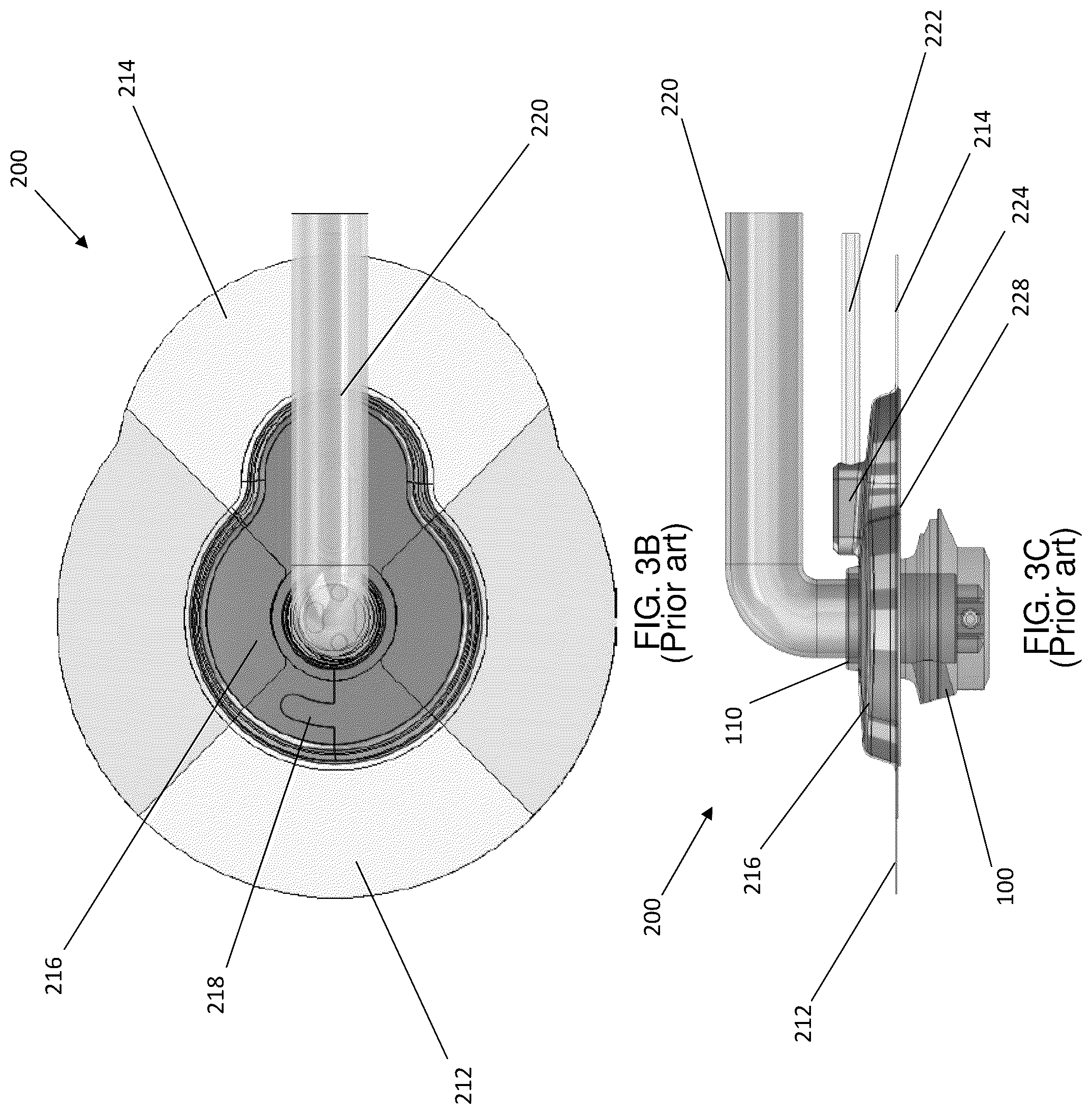 Patent US12097314 Figure 5 – Vacuum assisted skin penetrating appliance with external interface