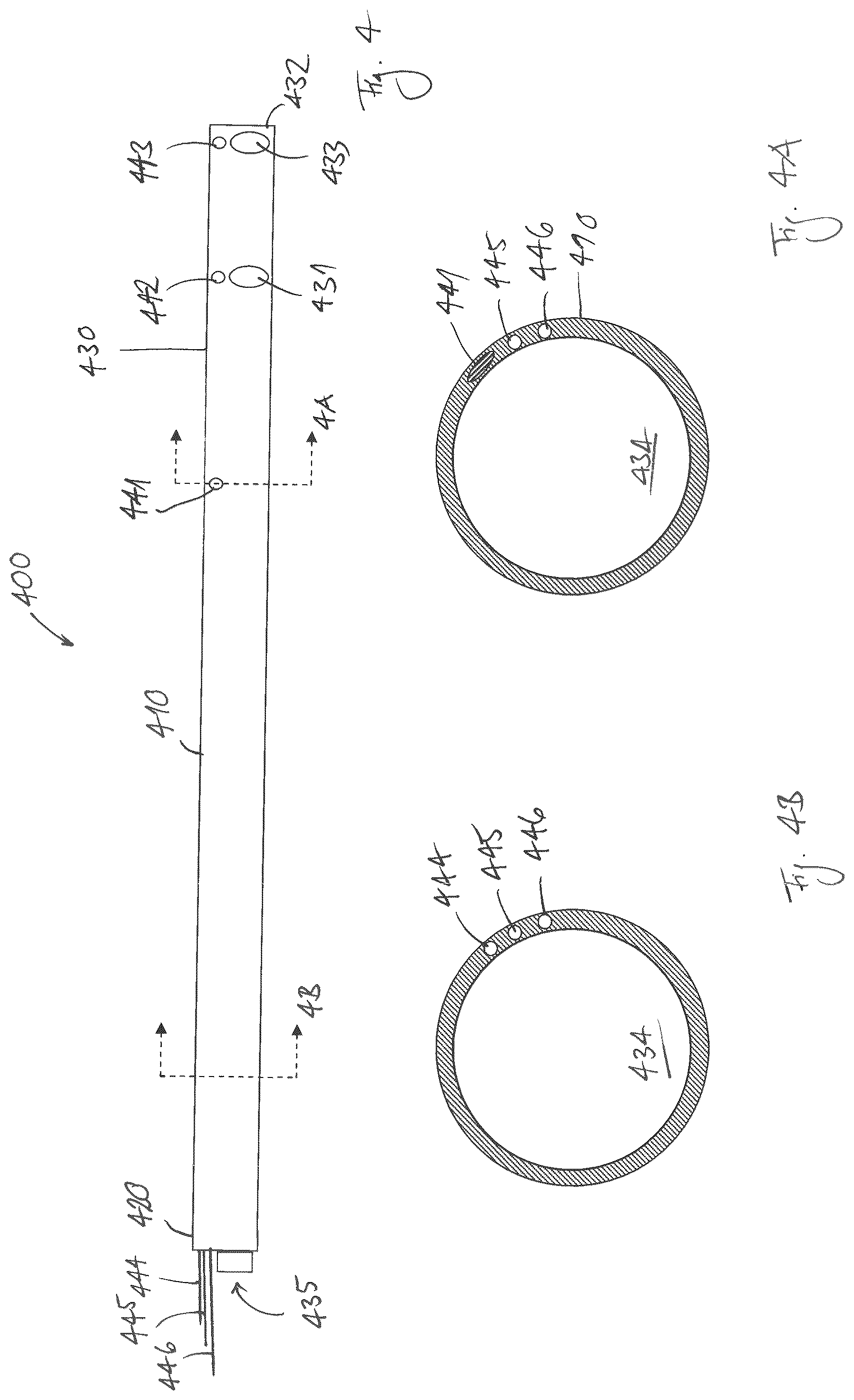 Patent US12097315 Figure 5 – Cardiac drainage cannula and related methods and systems