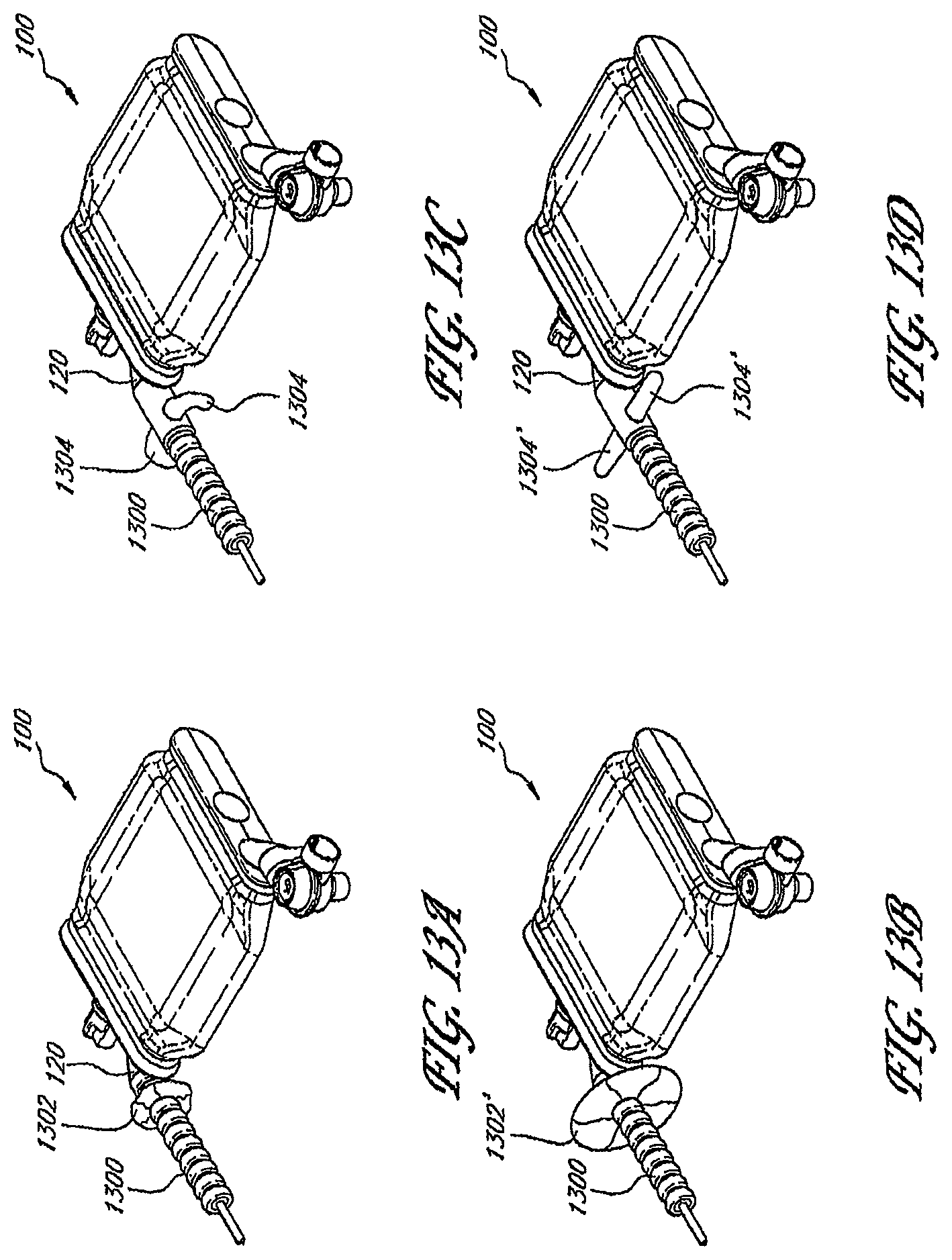 Patent US12097323 Figure 16 – Volume-adjustable manual ventilation device