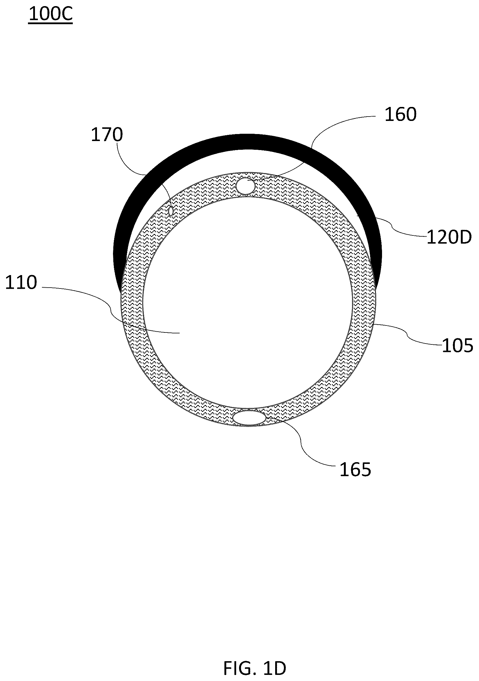 Patent US12097325 Figure 4 – Systems and devices for preventing occlusion of a suction line resident in a medical device