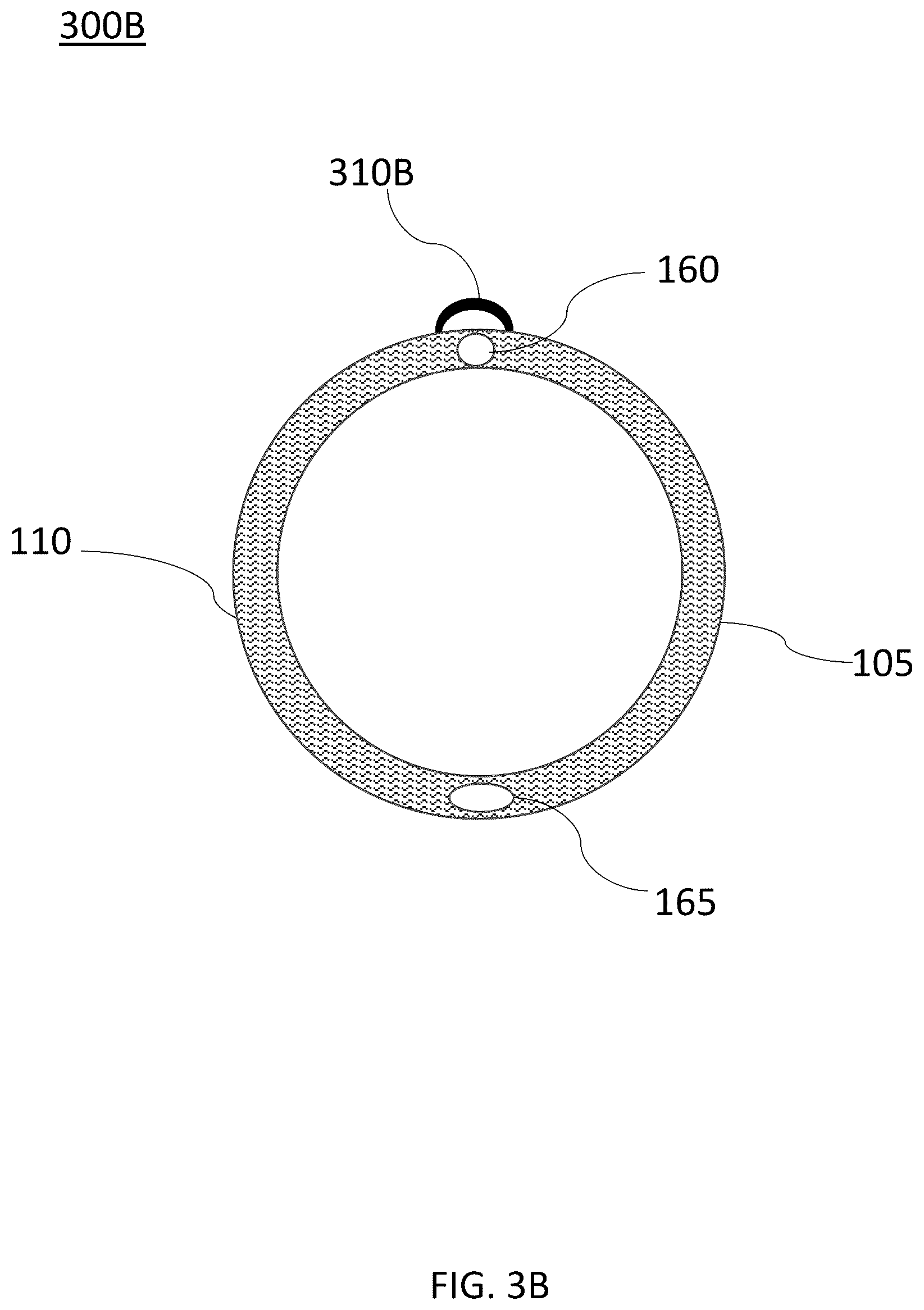 Patent US12097325 Figure 12 – Systems and devices for preventing occlusion of a suction line resident in a medical device