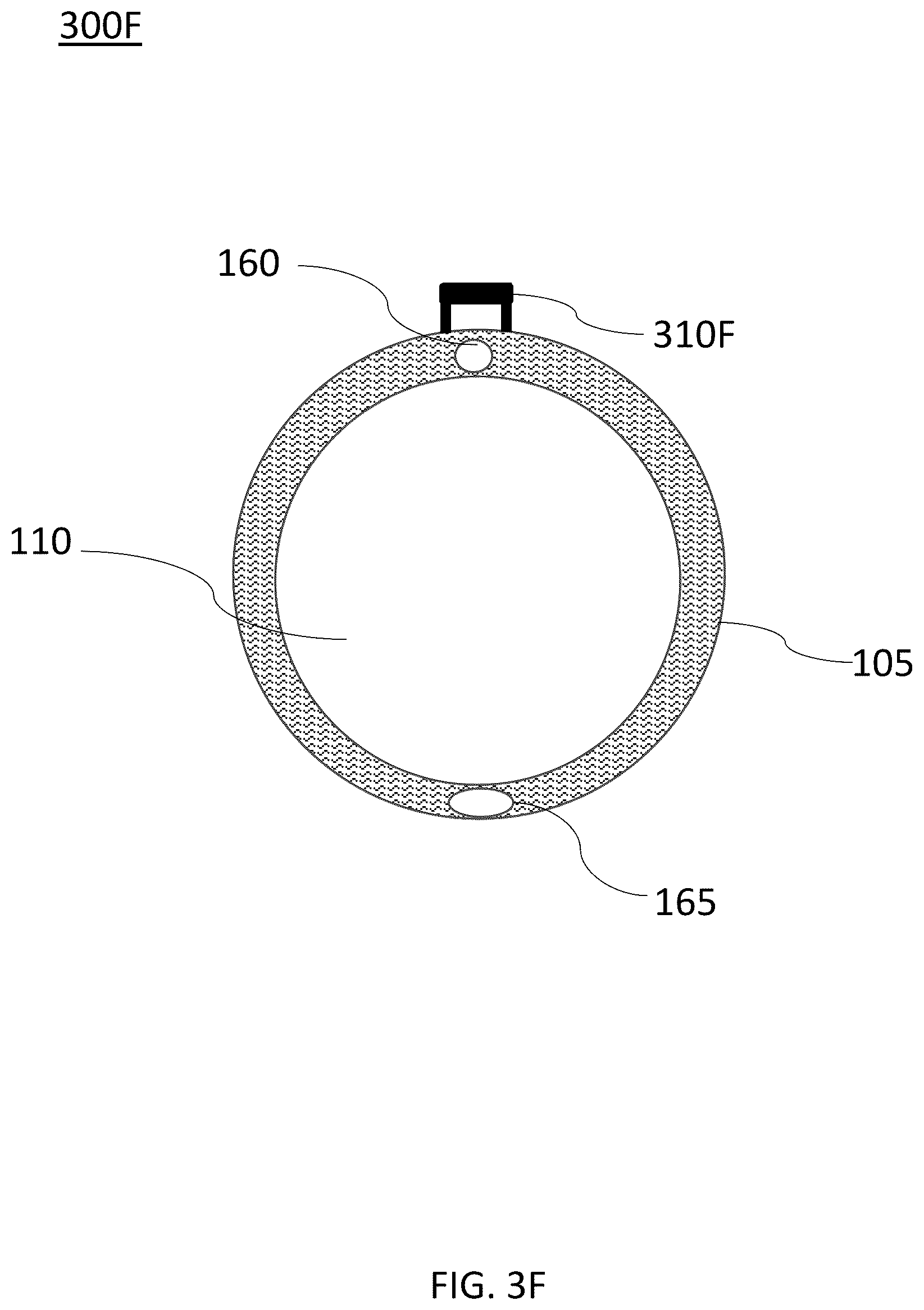 Patent US12097325 Figure 16 – Systems and devices for preventing occlusion of a suction line resident in a medical device