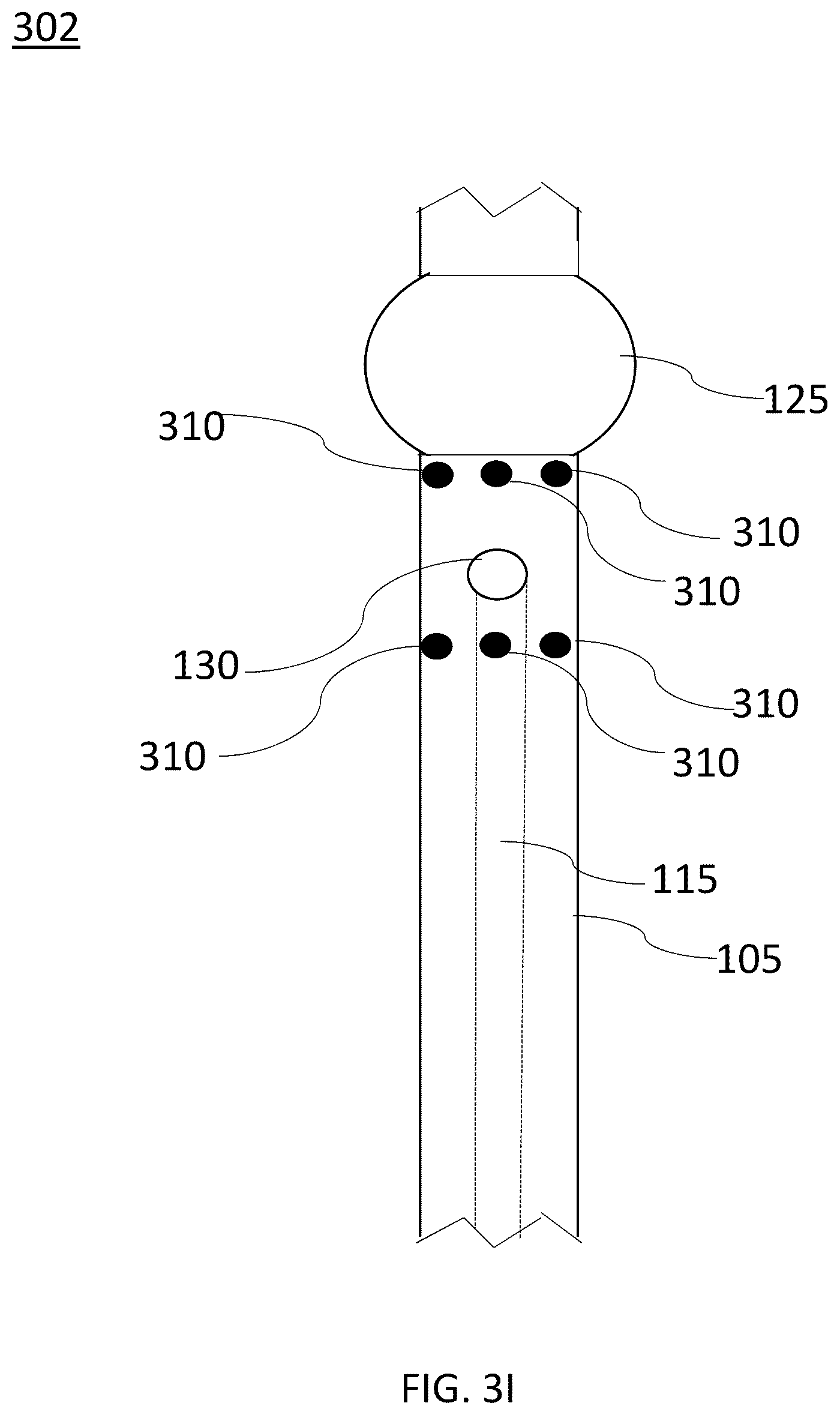 Patent US12097325 Figure 19 – Systems and devices for preventing occlusion of a suction line resident in a medical device