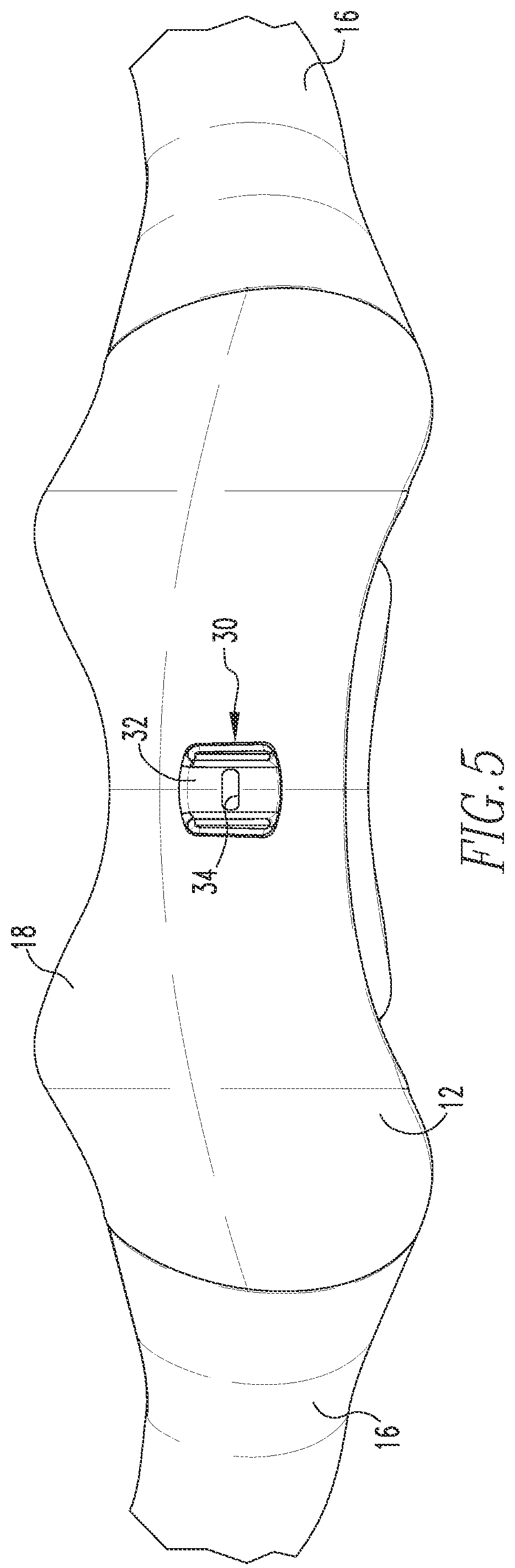 Patent US12097326 Figure 4 – Patient interface having a restrictor element for varying flow resistance through an exhalation port thereof
