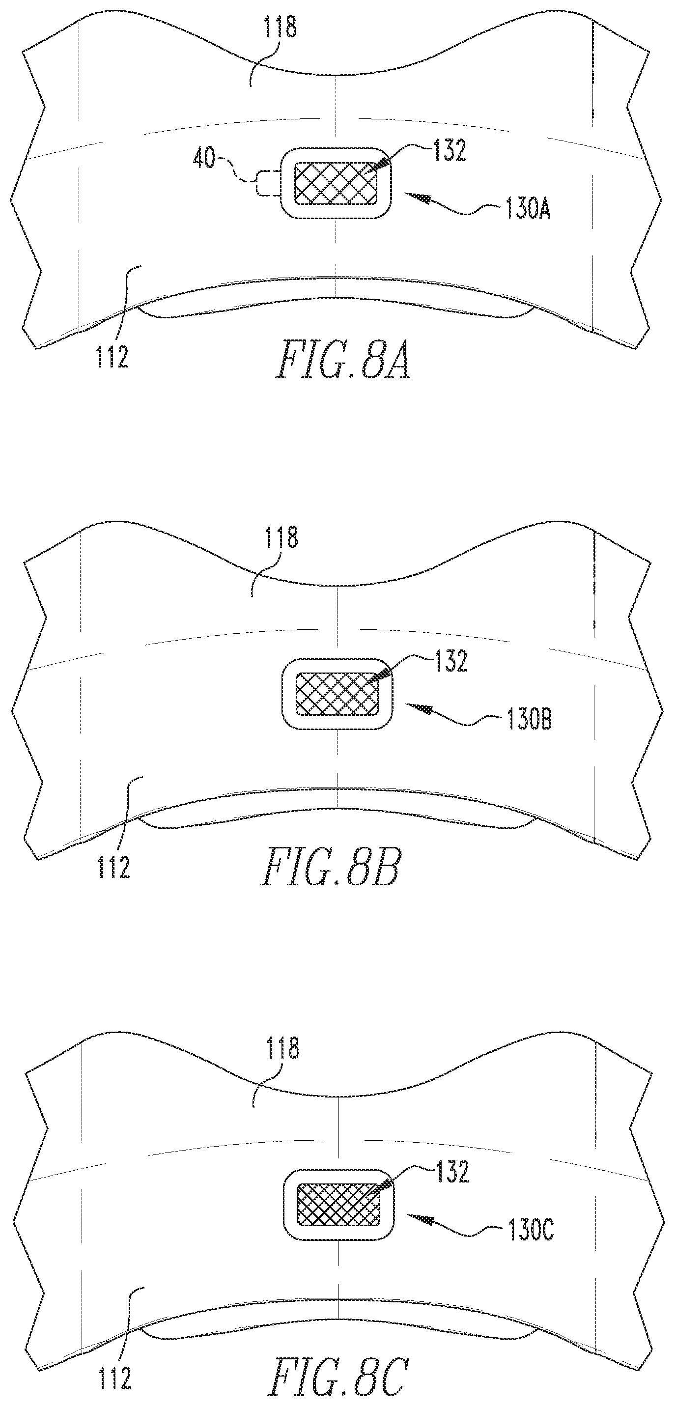 Patent US12097326 Figure 6 – Patient interface having a restrictor element for varying flow resistance through an exhalation port thereof