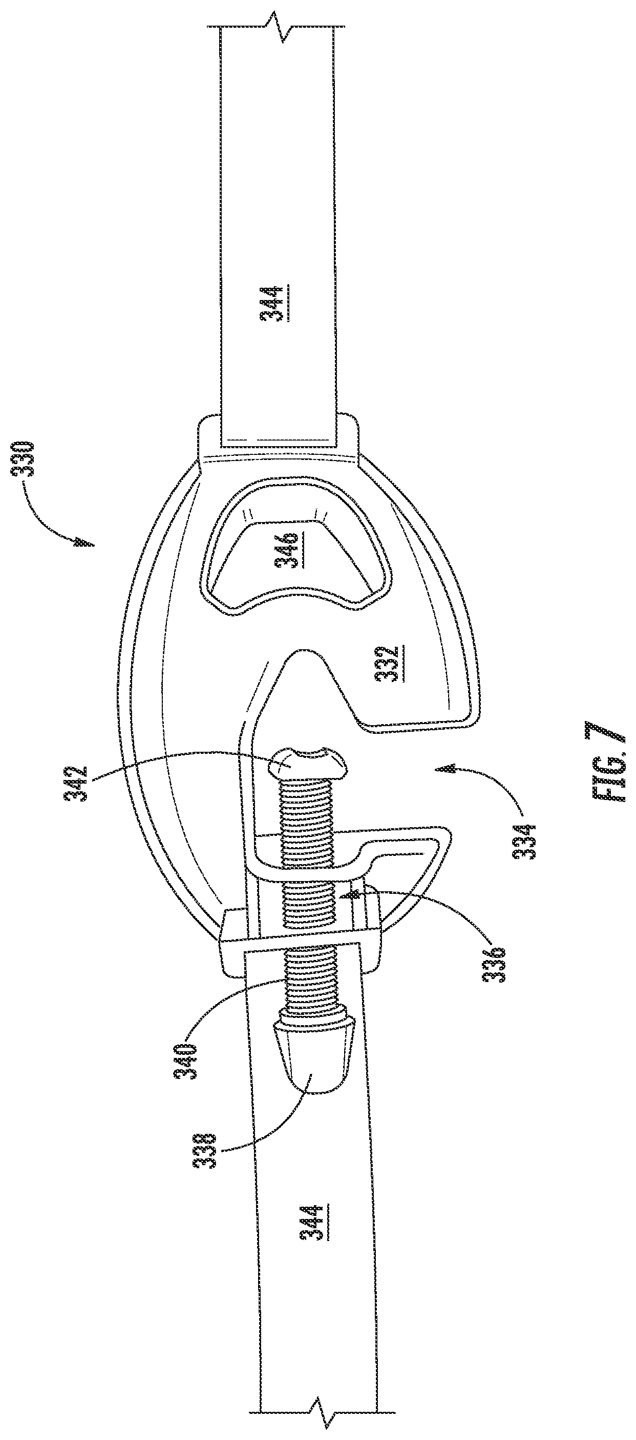 Patent US12097327 Figure 7 – Emergency respiratory support devices, systems, and methods