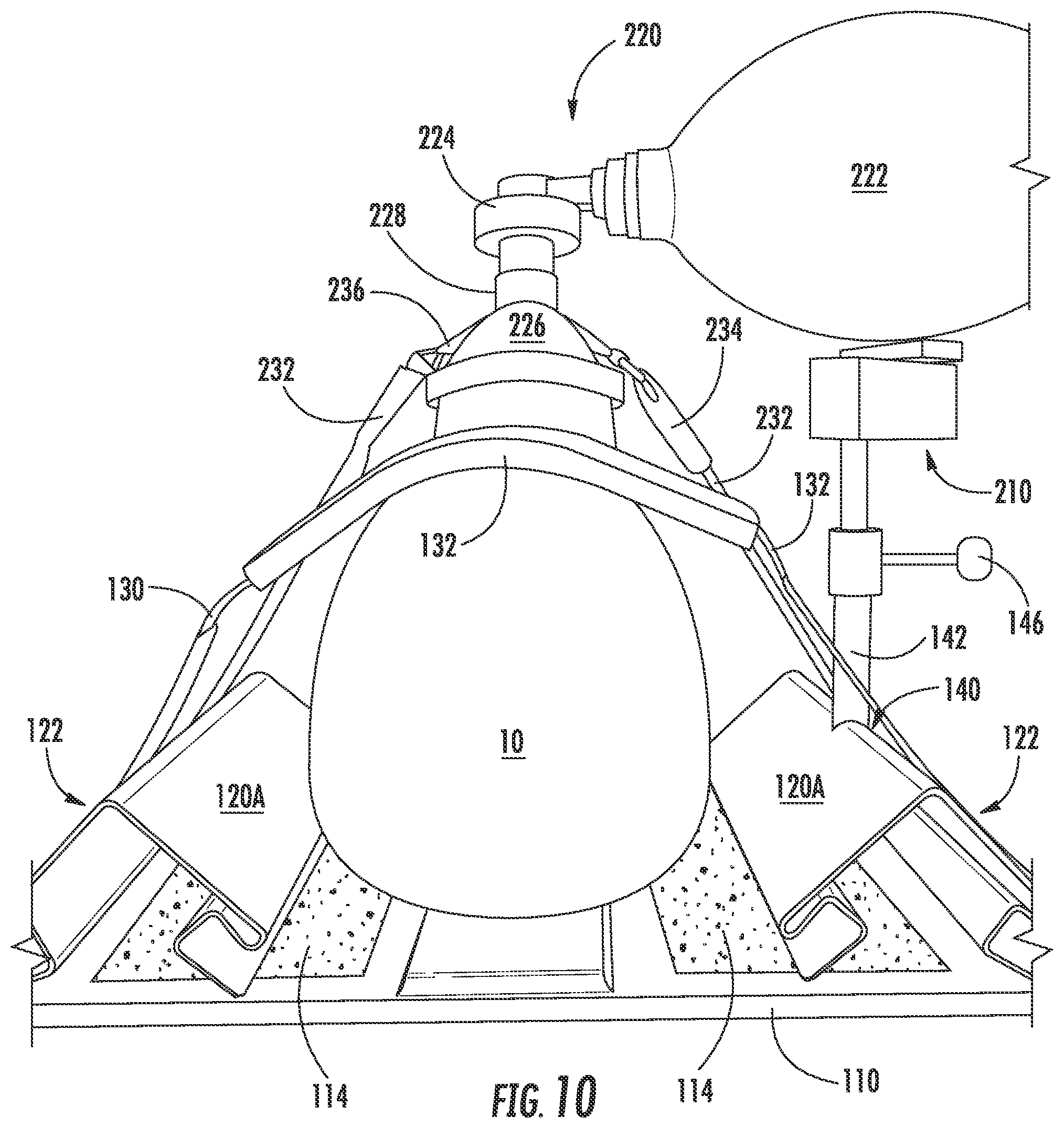 Patent US12097327 Figure 10 – Emergency respiratory support devices, systems, and methods