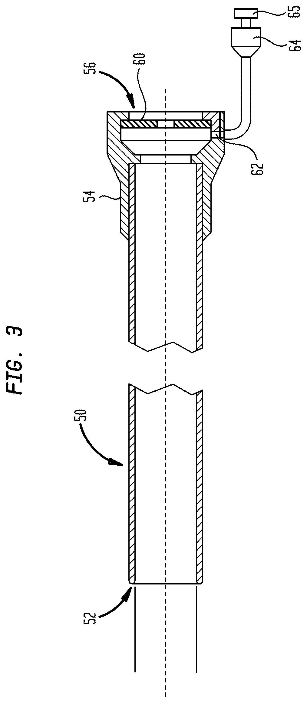 Patent US12097334 Figure 3 – Dilation delivery system for a medical device