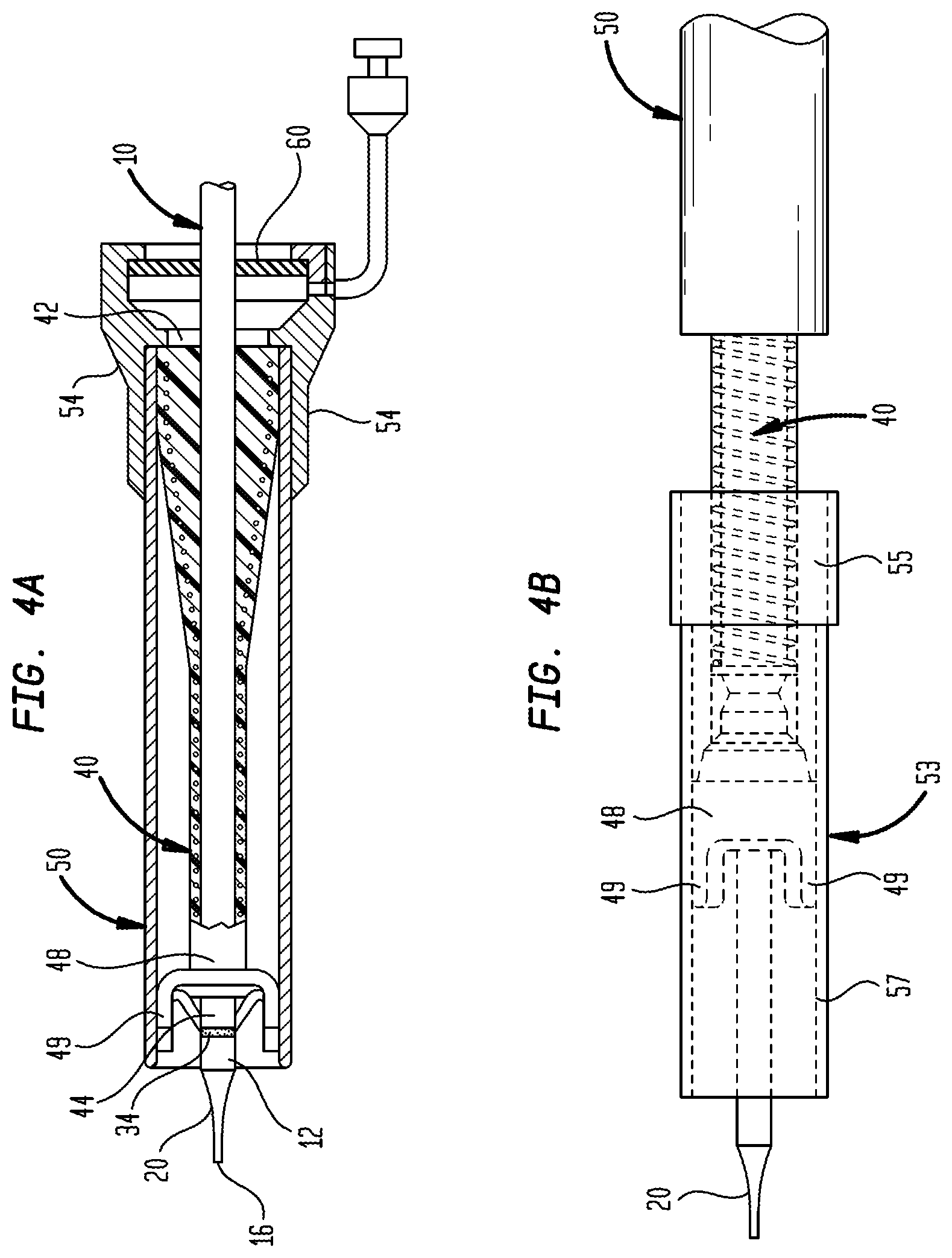 Patent US12097334 Figure 4 – Dilation delivery system for a medical device