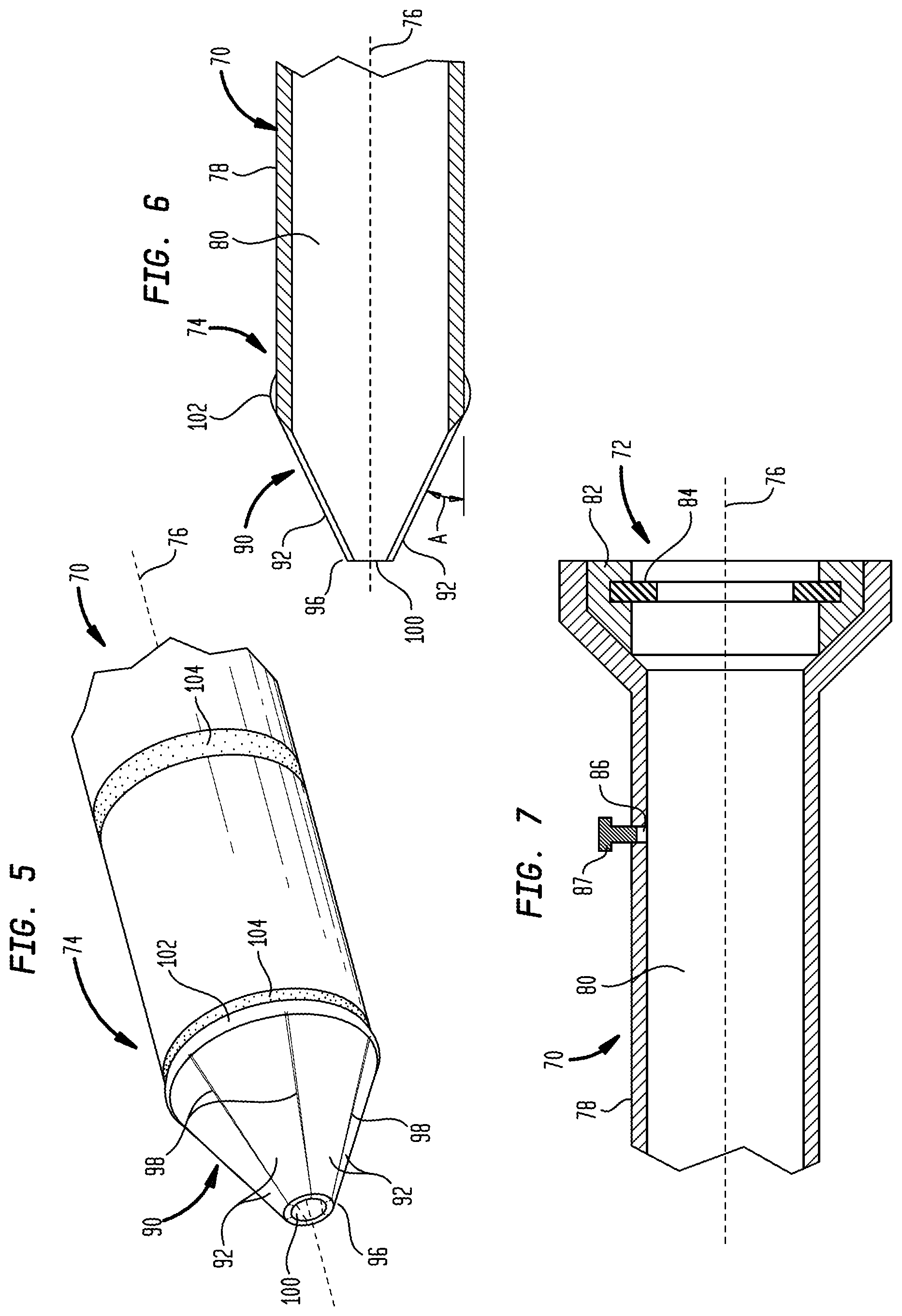 Patent US12097334 Figure 5 – Dilation delivery system for a medical device