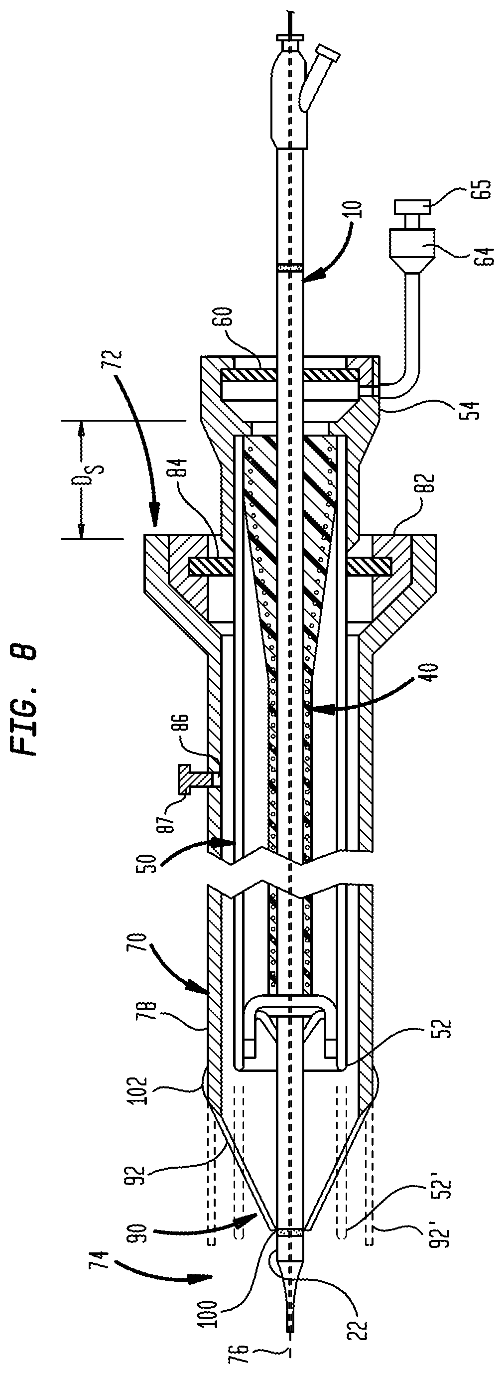 Patent US12097334 Figure 6 – Dilation delivery system for a medical device