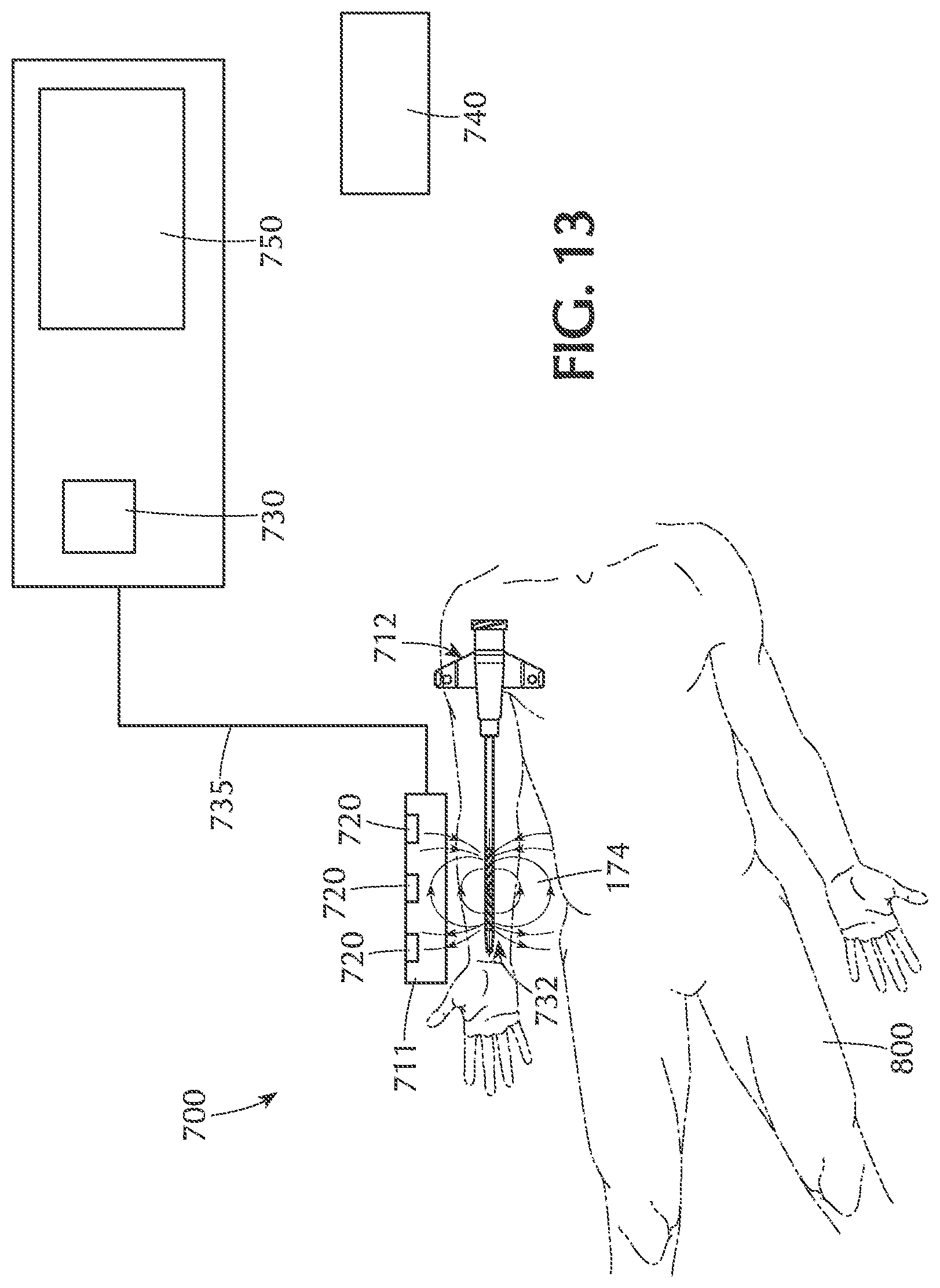 Patent US12097336 Figure 16 – Medical devices, systems and methods utilizing permanent magnet and magnetizable feature