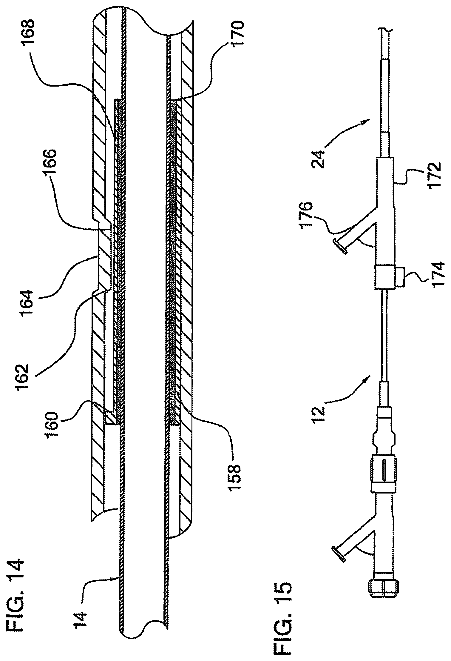 Patent US12097338 Figure 10 – Coaxial bi-directional catheter