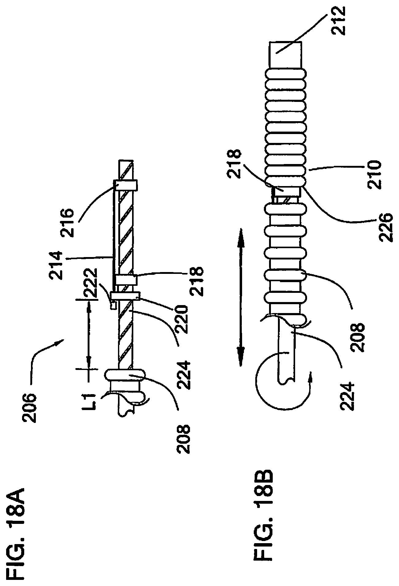 Patent US12097338 Figure 12 – Coaxial bi-directional catheter