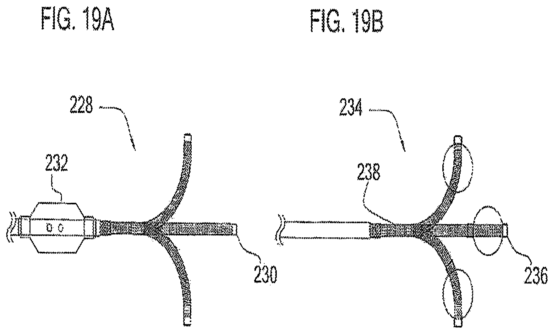 Patent US12097338 Figure 13 – Coaxial bi-directional catheter