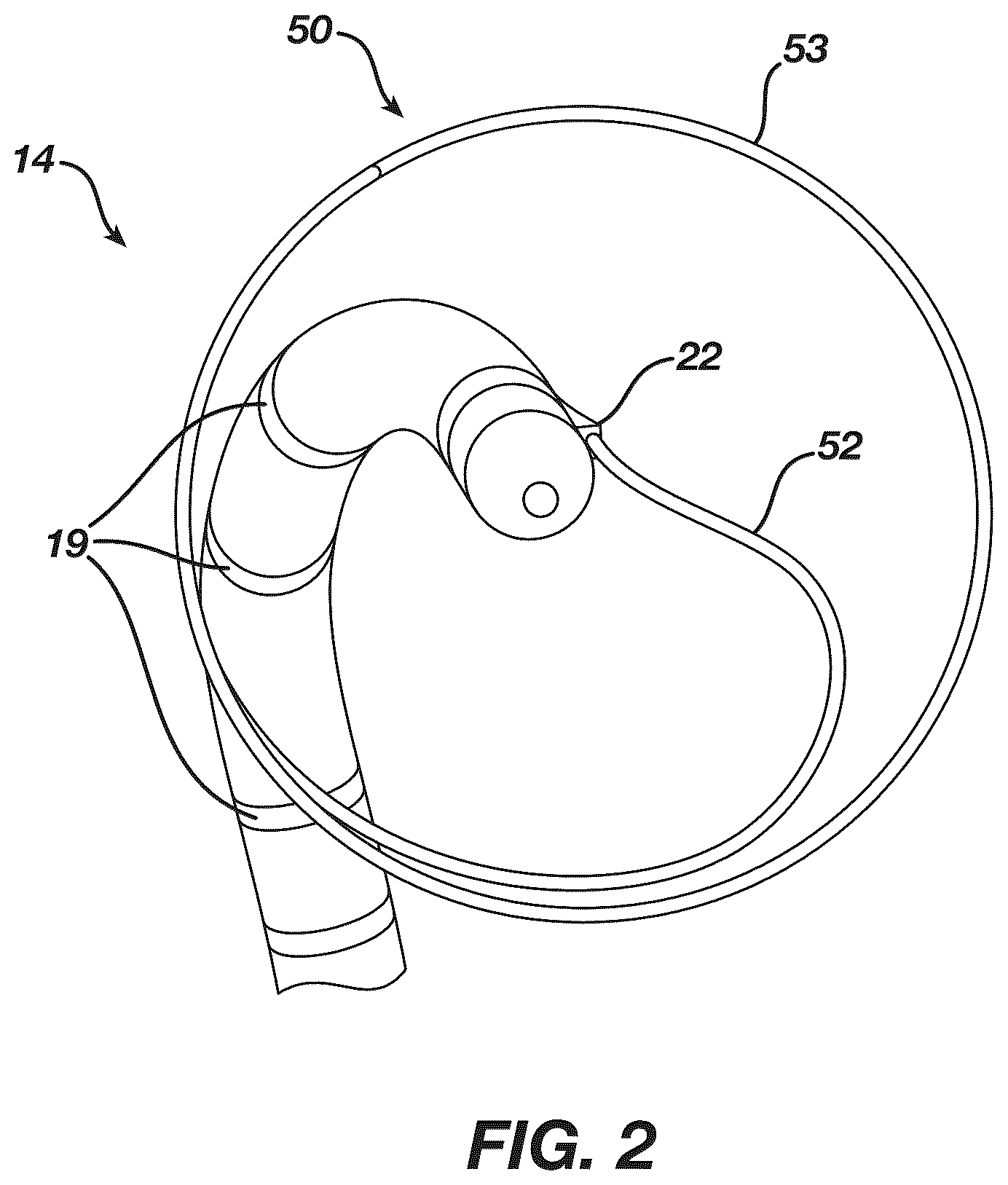 Patent US12097339 Figure 2 – System and methods of using a catheter with an anchoring mechanism