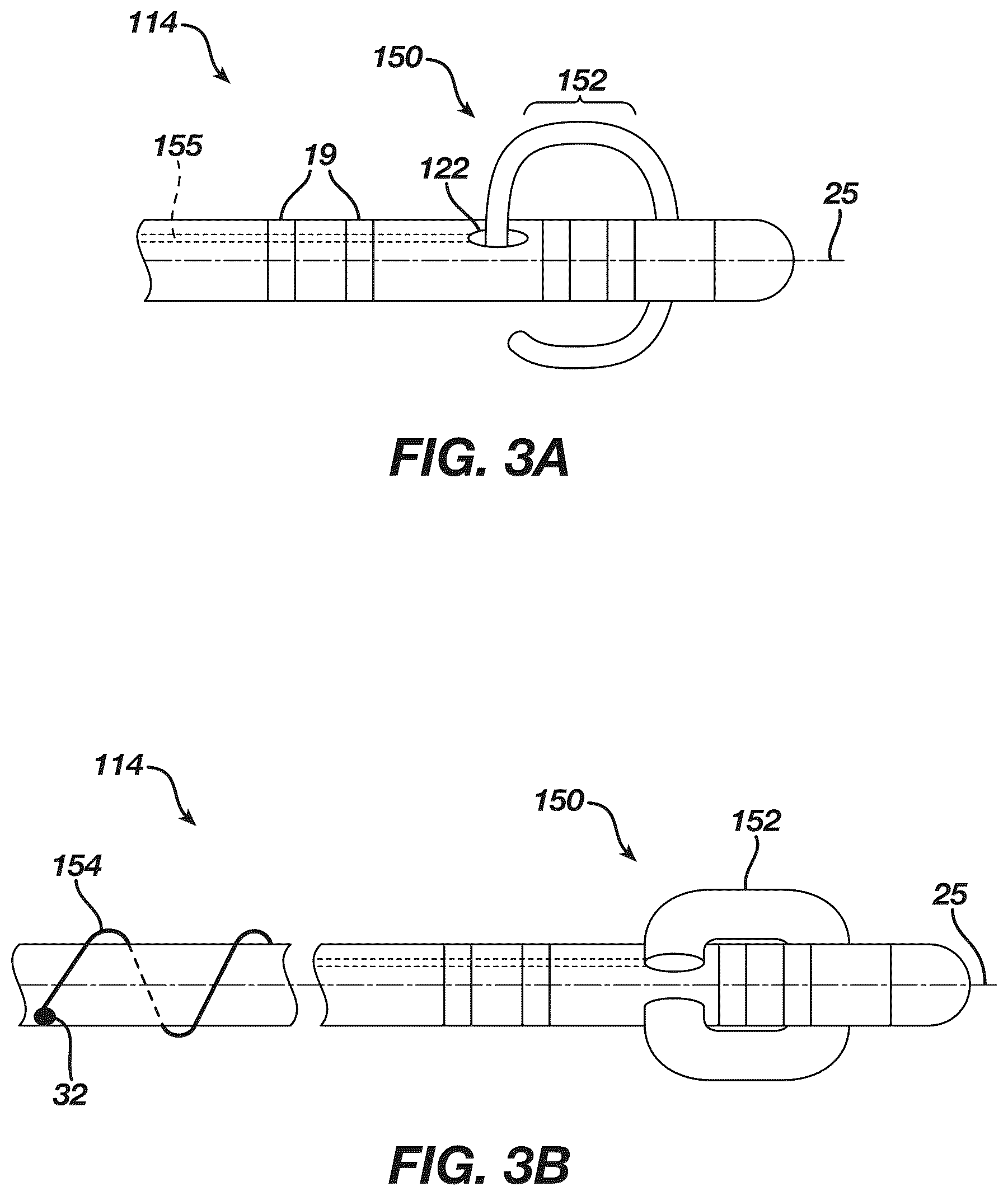 Patent US12097339 Figure 3 – System and methods of using a catheter with an anchoring mechanism