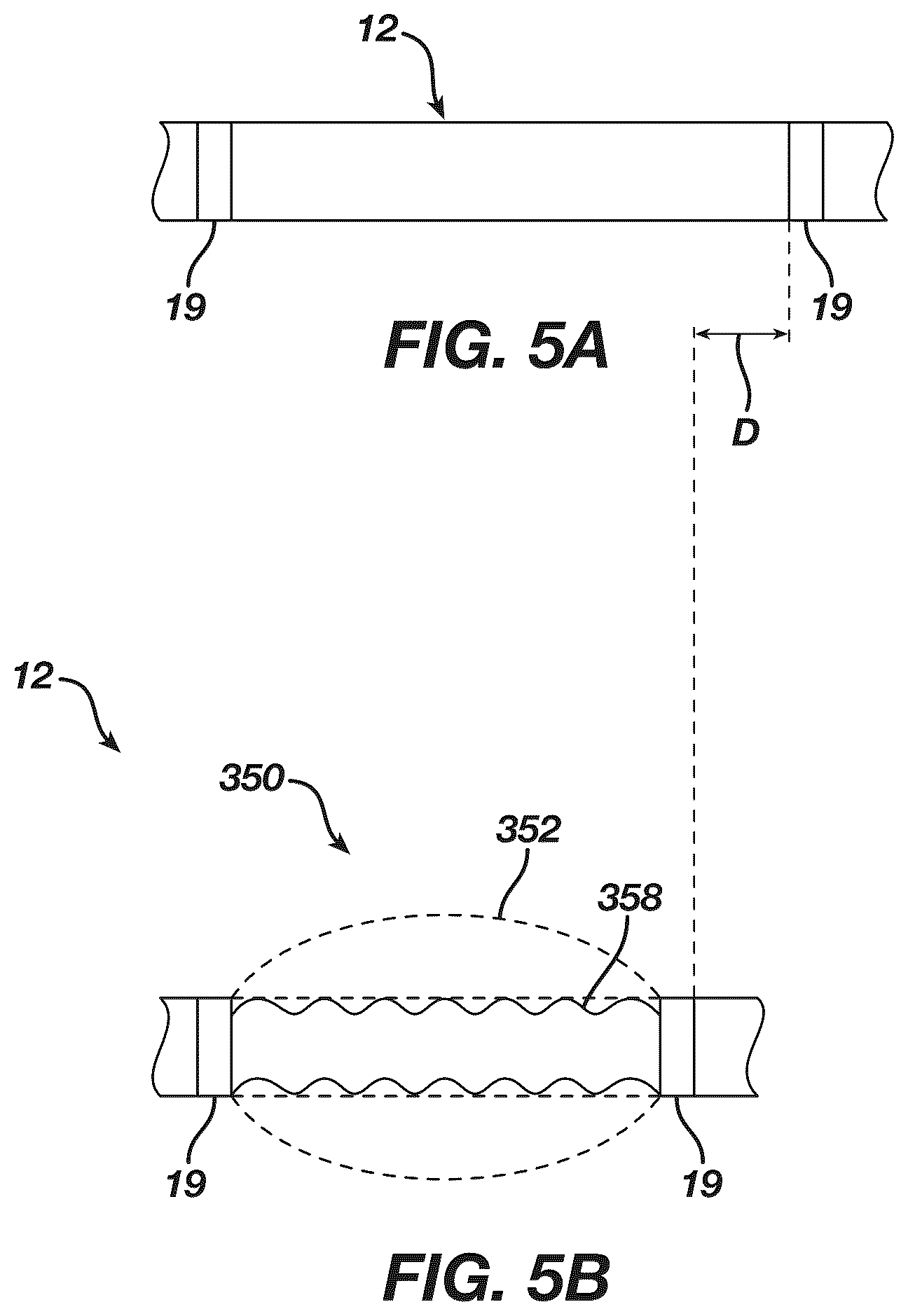 Patent US12097339 Figure 5 – System and methods of using a catheter with an anchoring mechanism
