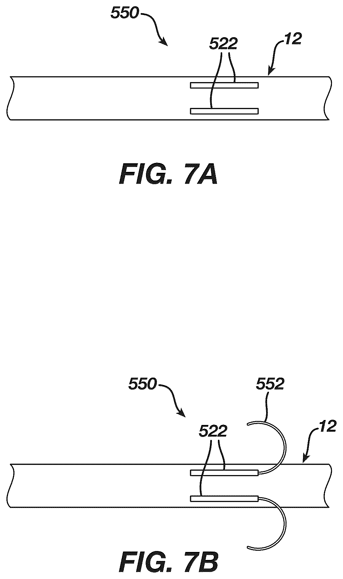 Patent US12097339 Figure 7 – System and methods of using a catheter with an anchoring mechanism