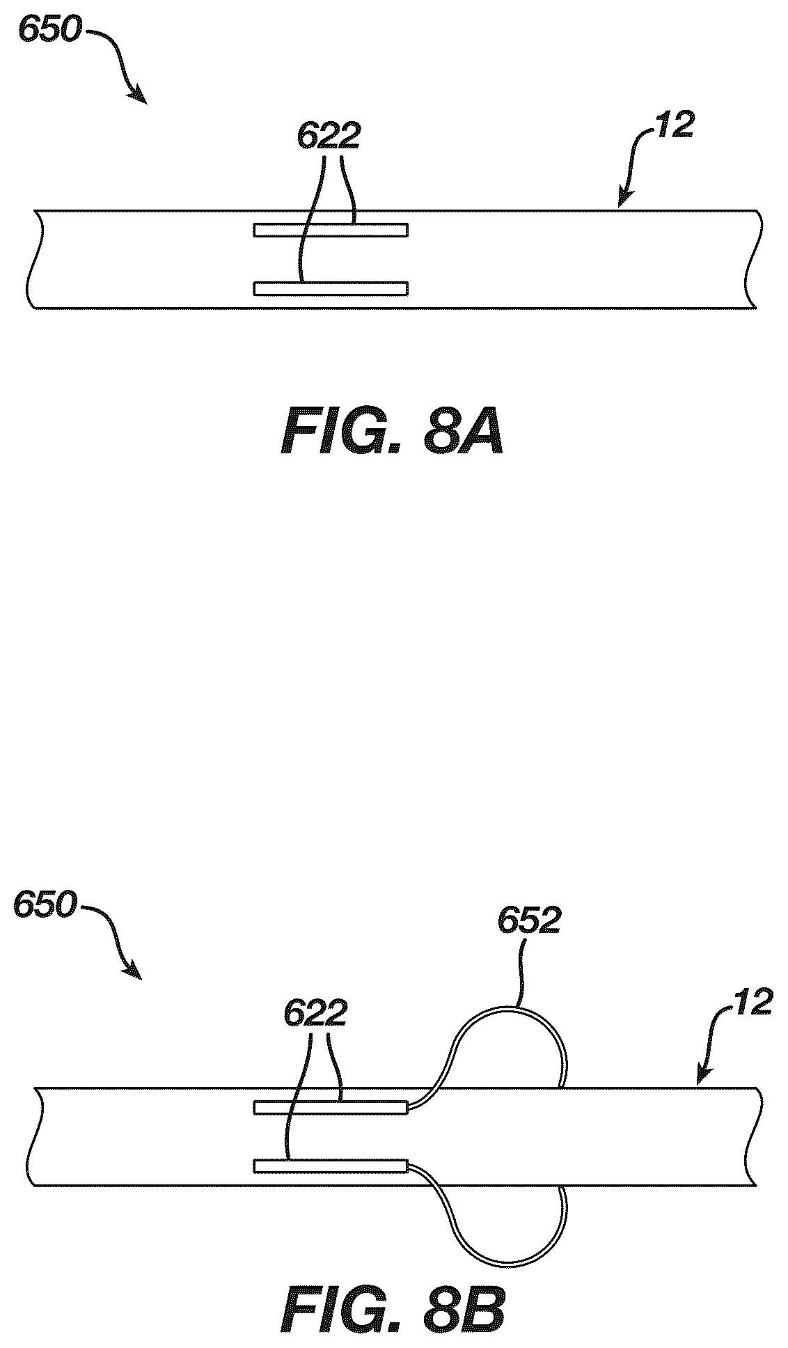 Patent US12097339 Figure 8 – System and methods of using a catheter with an anchoring mechanism