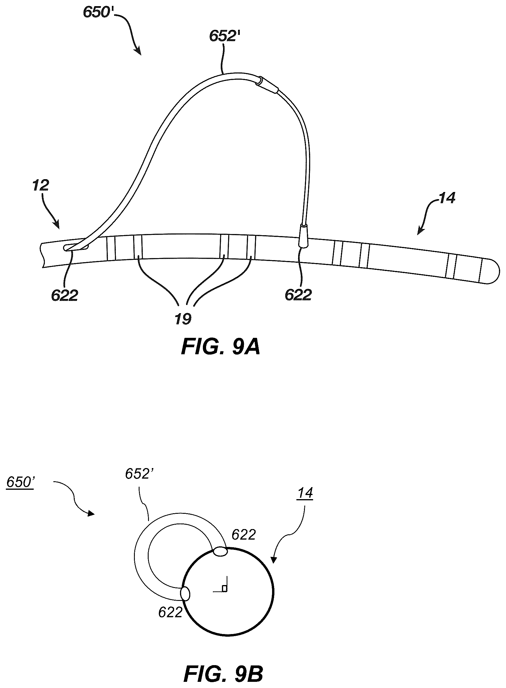 Patent US12097339 Figure 9 – System and methods of using a catheter with an anchoring mechanism