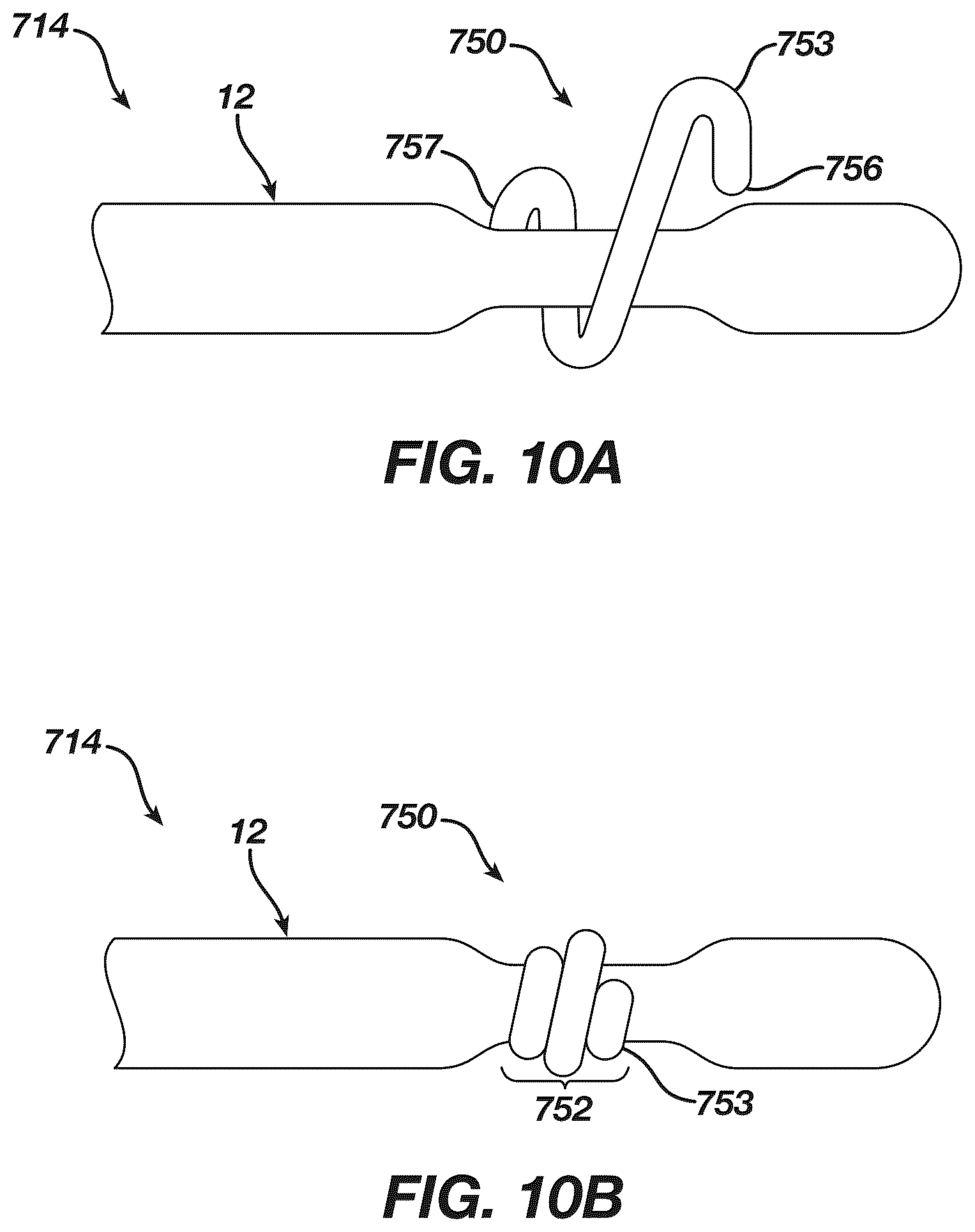 Patent US12097339 Figure 10 – System and methods of using a catheter with an anchoring mechanism