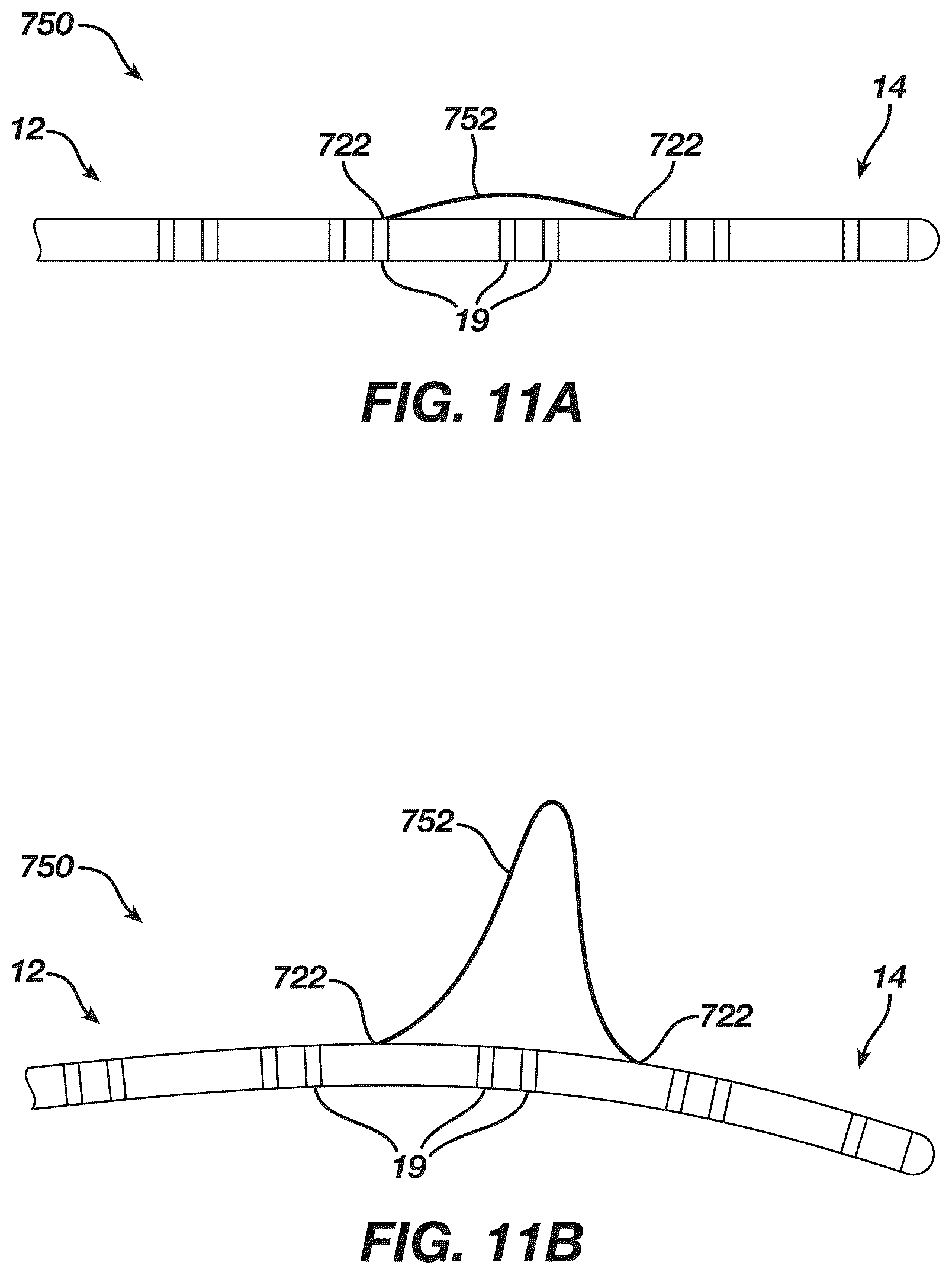 Patent US12097339 Figure 11 – System and methods of using a catheter with an anchoring mechanism
