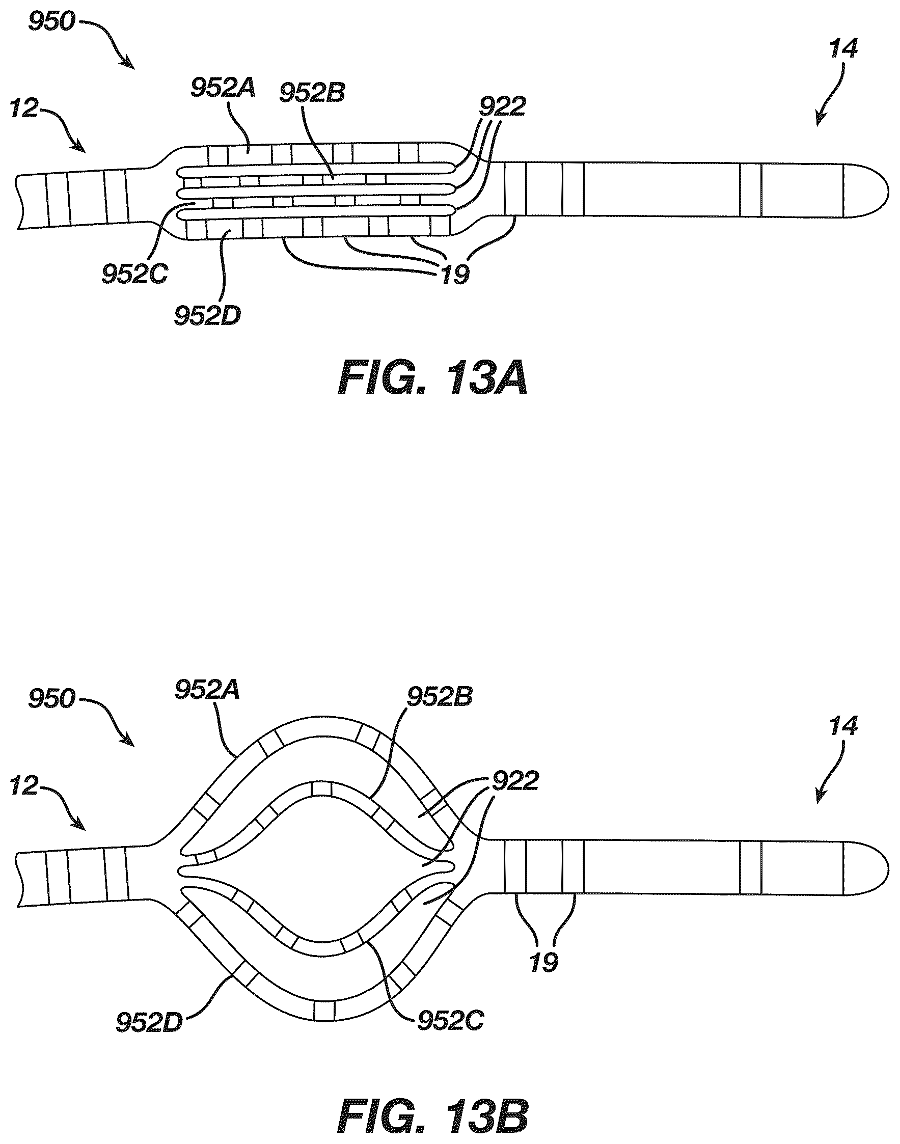 Patent US12097339 Figure 13 – System and methods of using a catheter with an anchoring mechanism