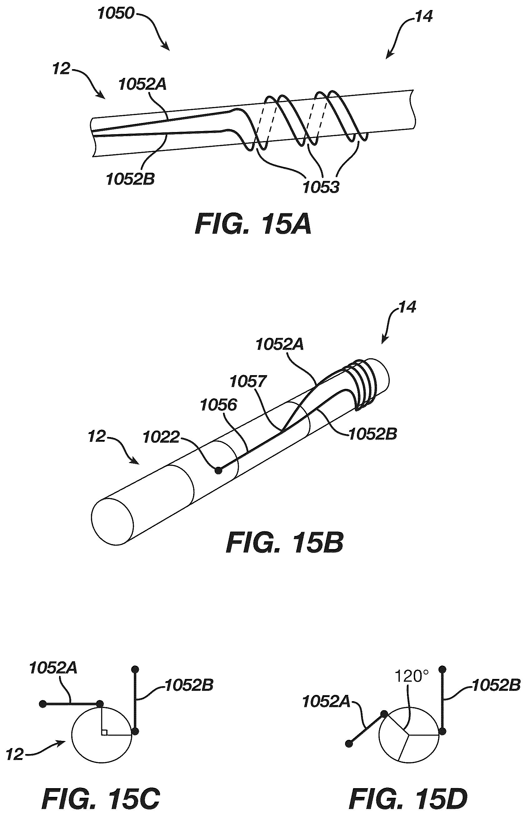 Patent US12097339 Figure 15 – System and methods of using a catheter with an anchoring mechanism