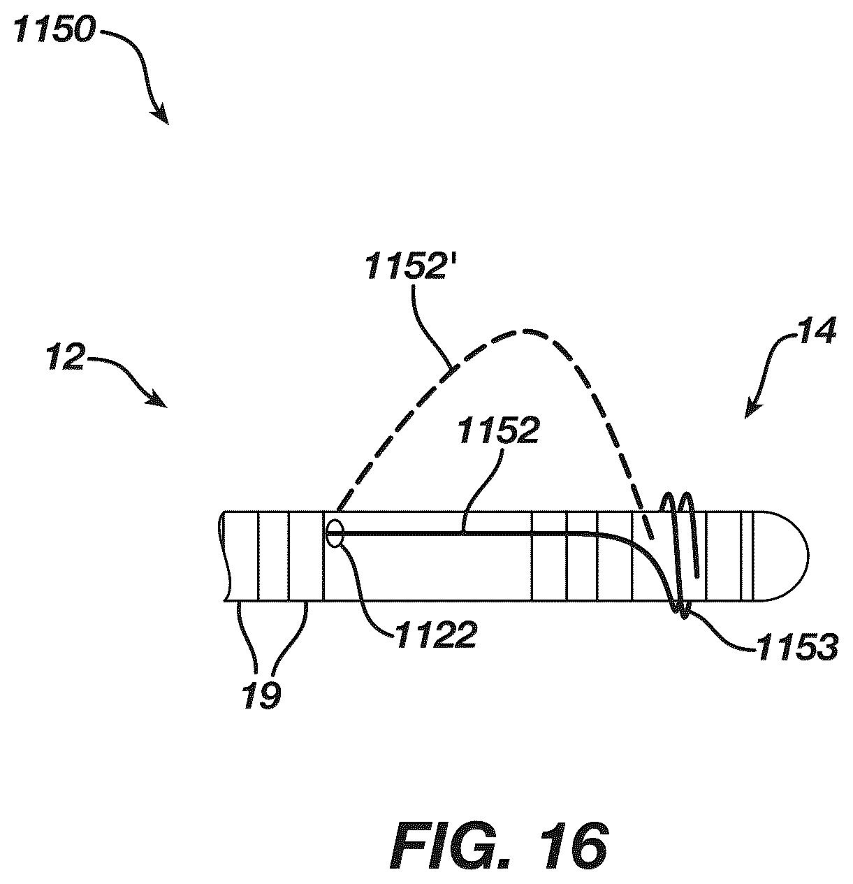 Patent US12097339 Figure 16 – System and methods of using a catheter with an anchoring mechanism