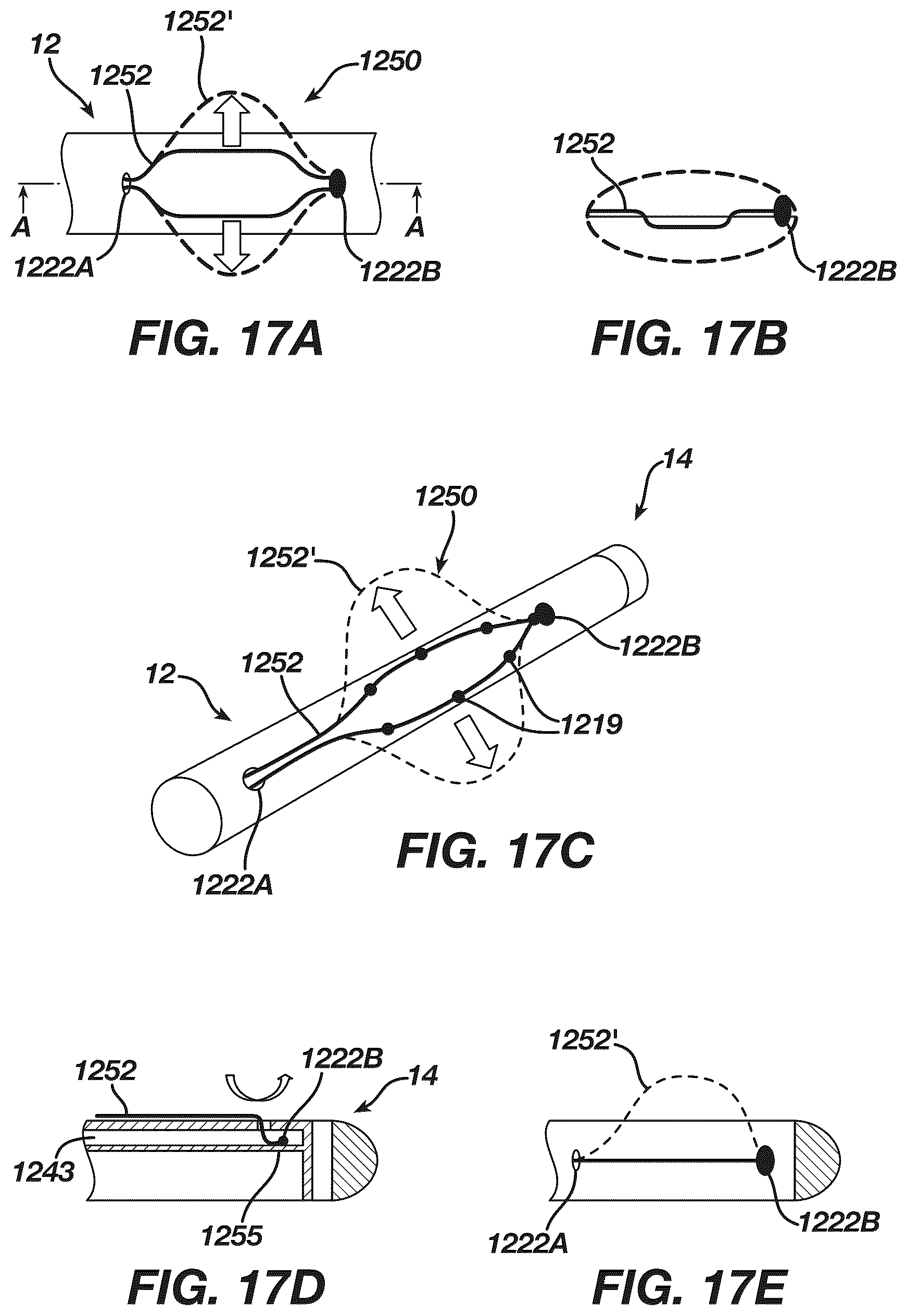 Patent US12097339 Figure 17 – System and methods of using a catheter with an anchoring mechanism