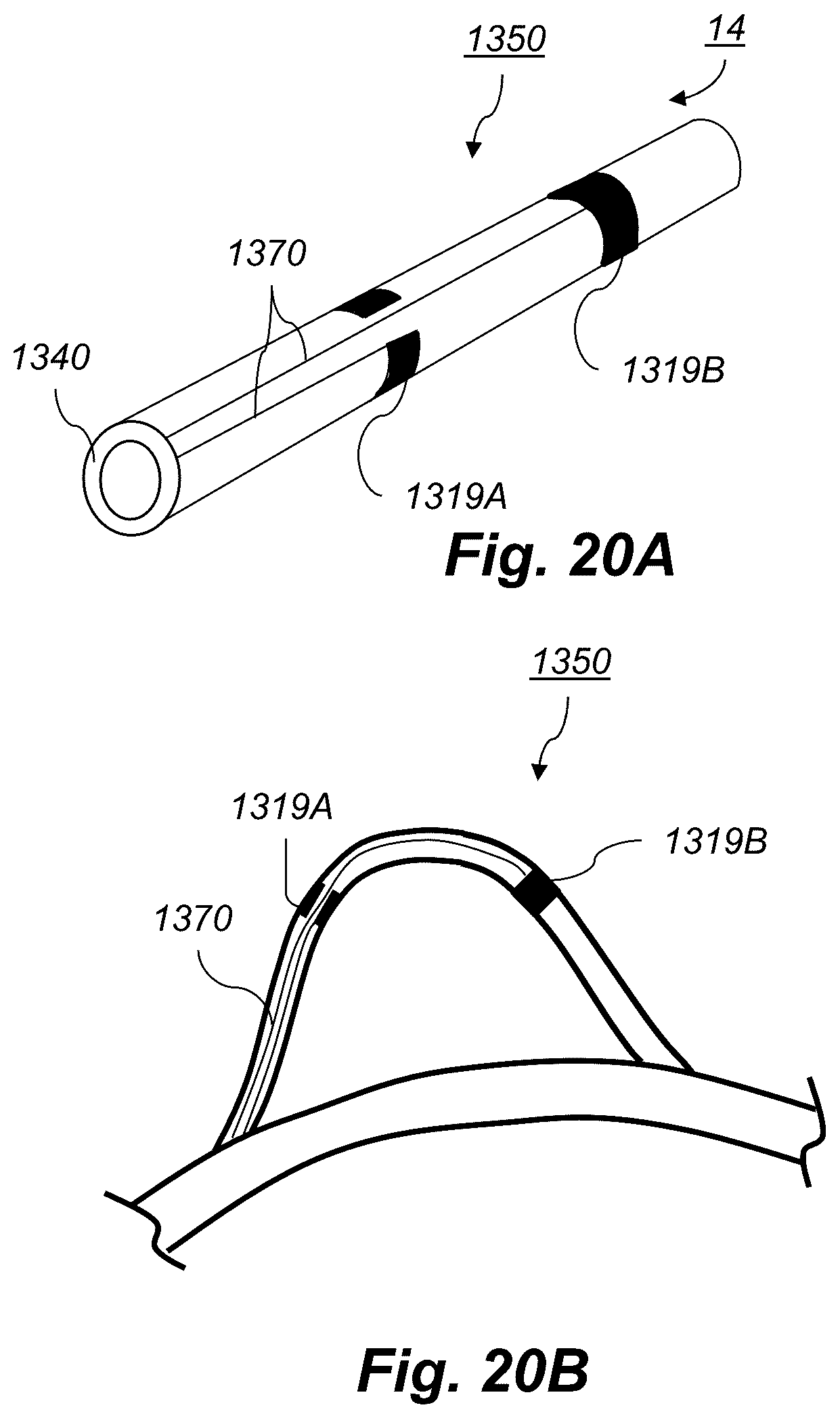 Patent US12097339 Figure 20 – System and methods of using a catheter with an anchoring mechanism