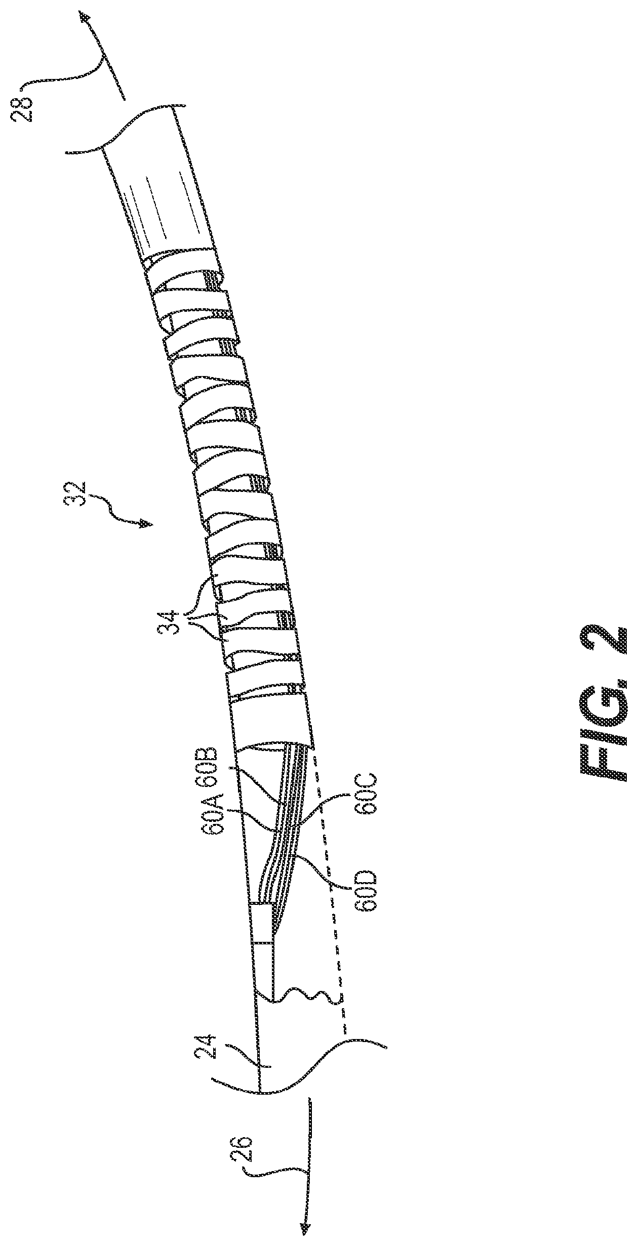 Patent US12097341 Figure 2 – Steerable catheter with brake assembly