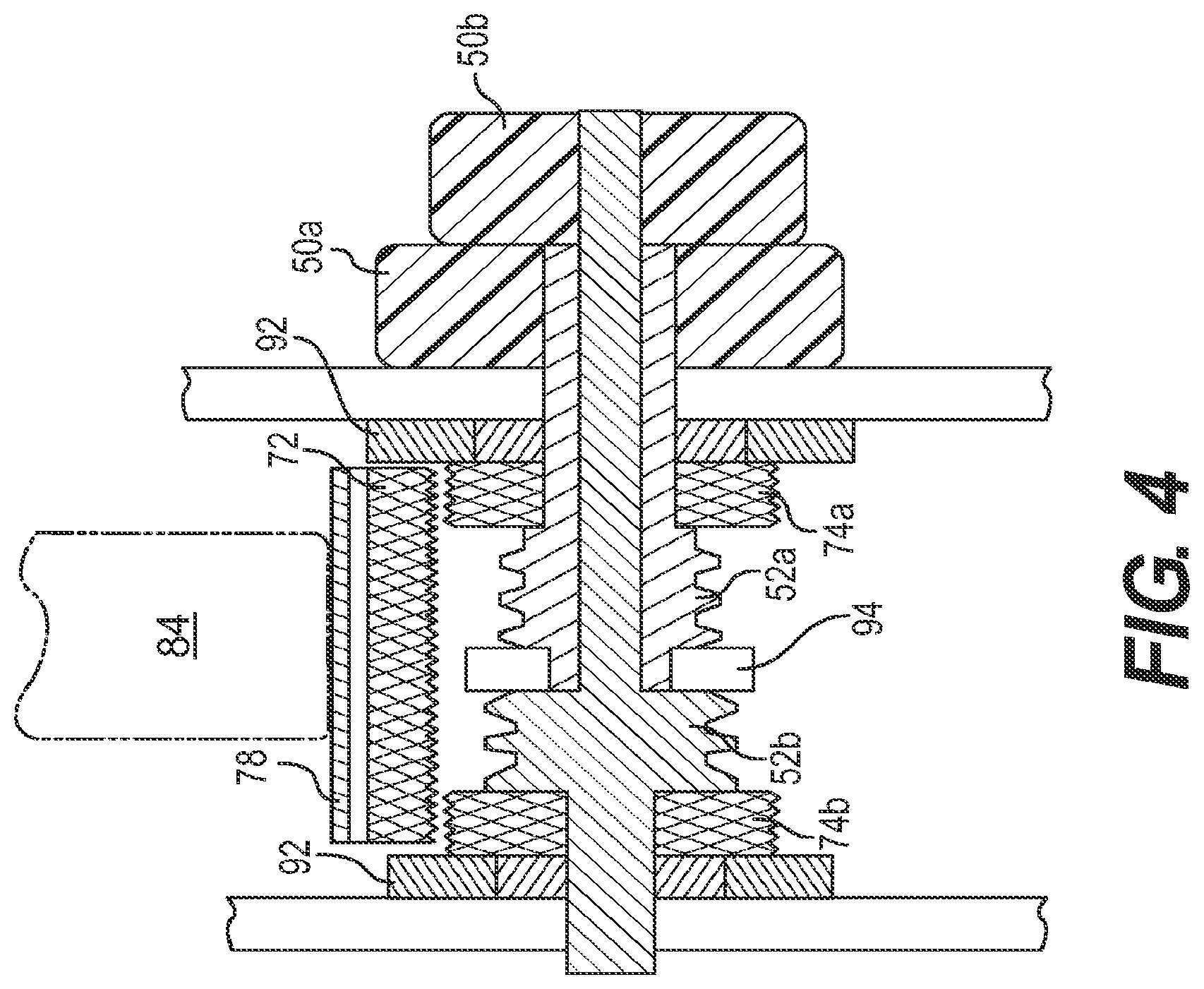 Patent US12097341 Figure 4 – Steerable catheter with brake assembly