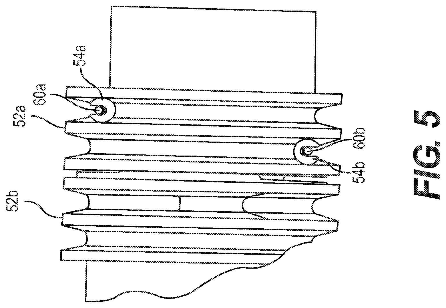 Patent US12097341 Figure 5 – Steerable catheter with brake assembly