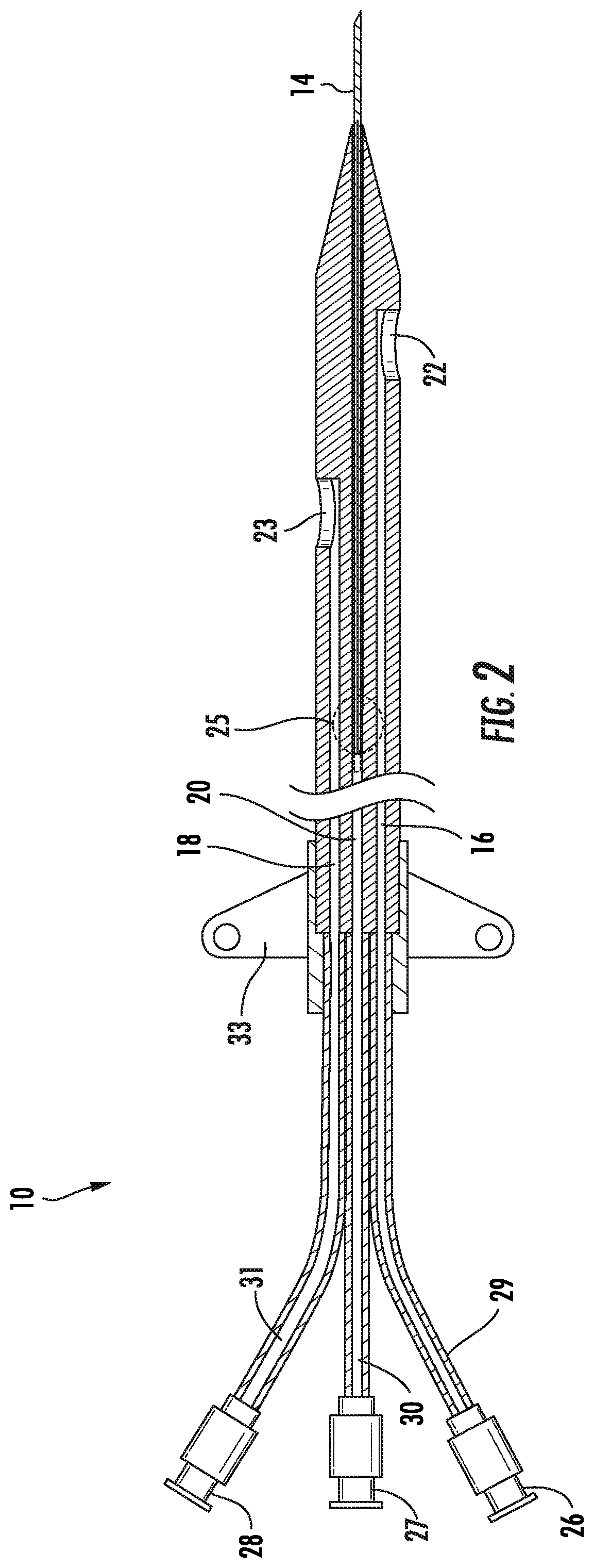 Patent US12097342 Figure 2 – Rapid insertion integrated catheter and method of using an integrated catheter