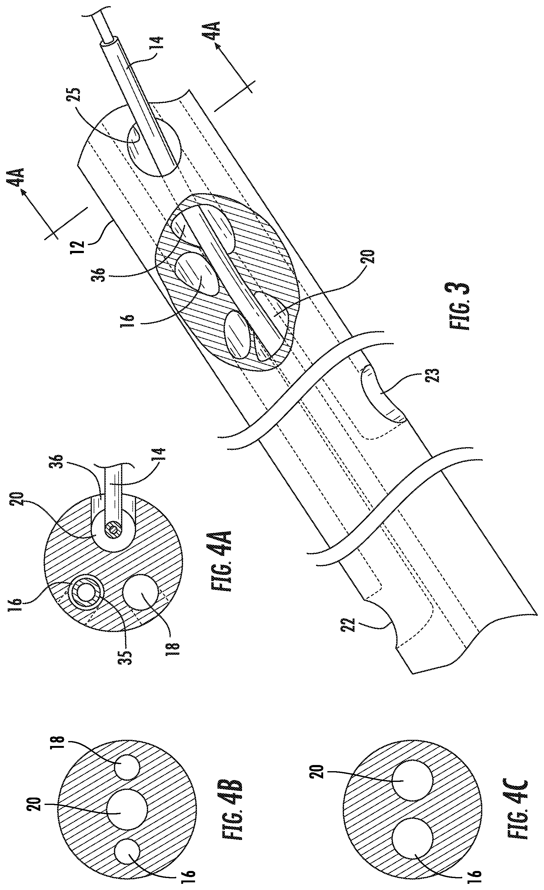 Patent US12097342 Figure 3 – Rapid insertion integrated catheter and method of using an integrated catheter
