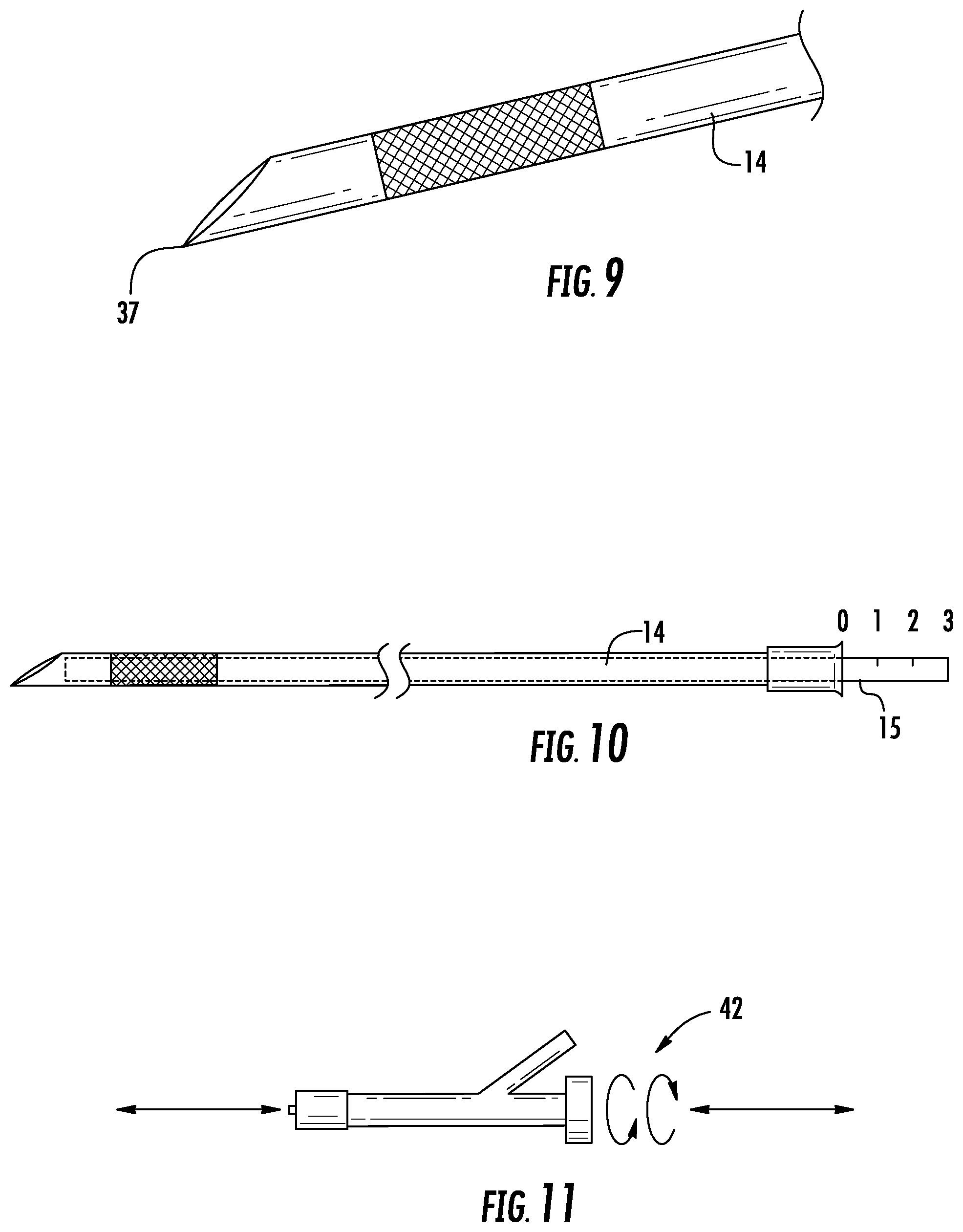Patent US12097342 Figure 6 – Rapid insertion integrated catheter and method of using an integrated catheter