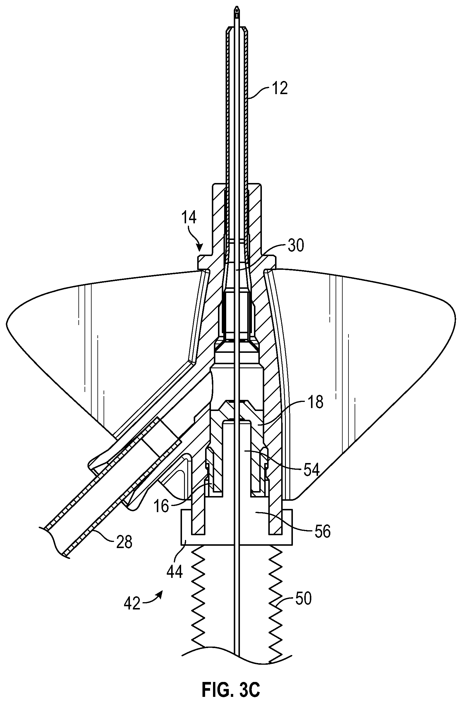 Patent US12097343 Figure 7 – Systems and methods to improve instrument guidance within an intravenous catheter assembly
