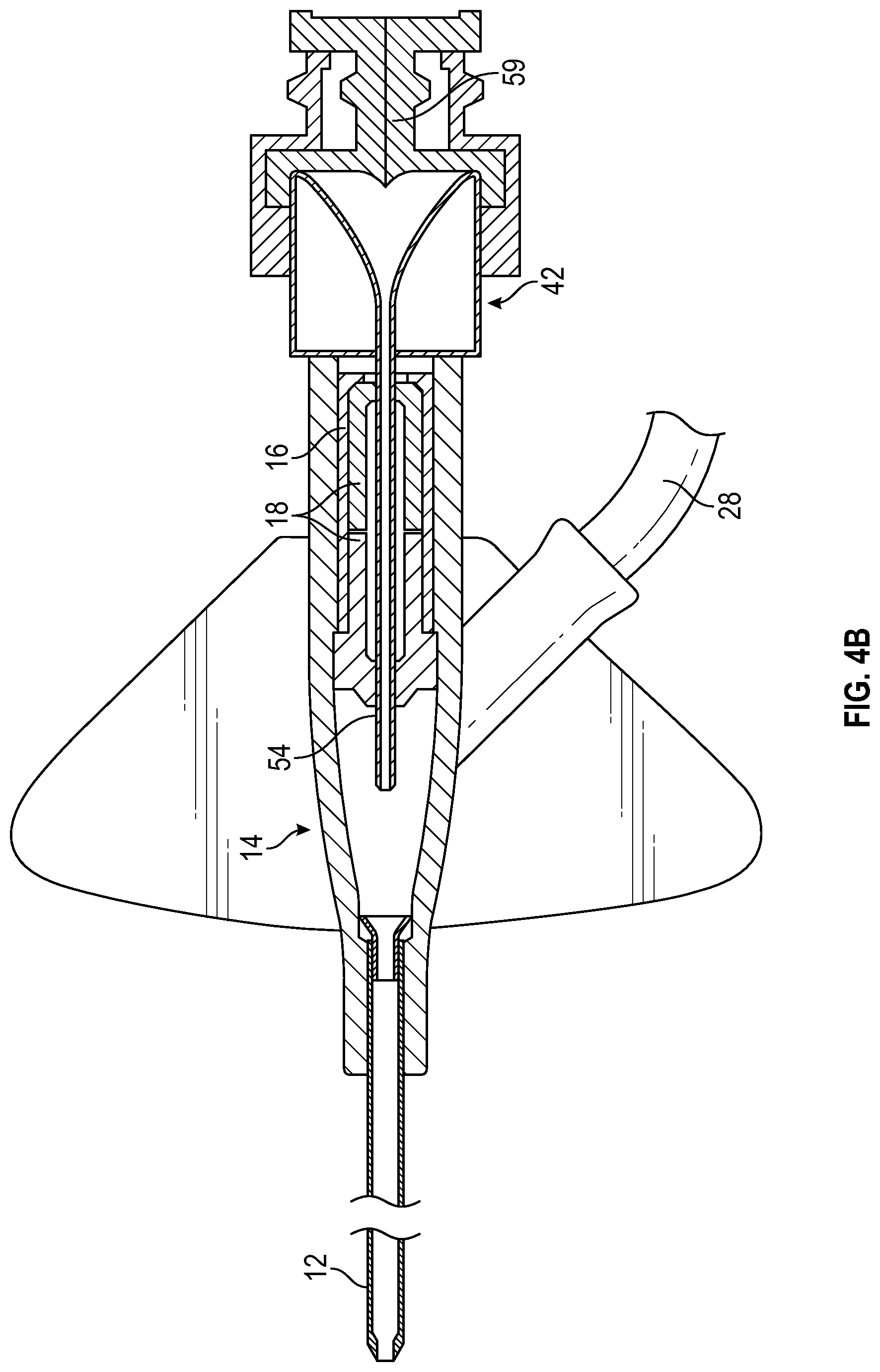 Patent US12097343 Figure 10 – Systems and methods to improve instrument guidance within an intravenous catheter assembly