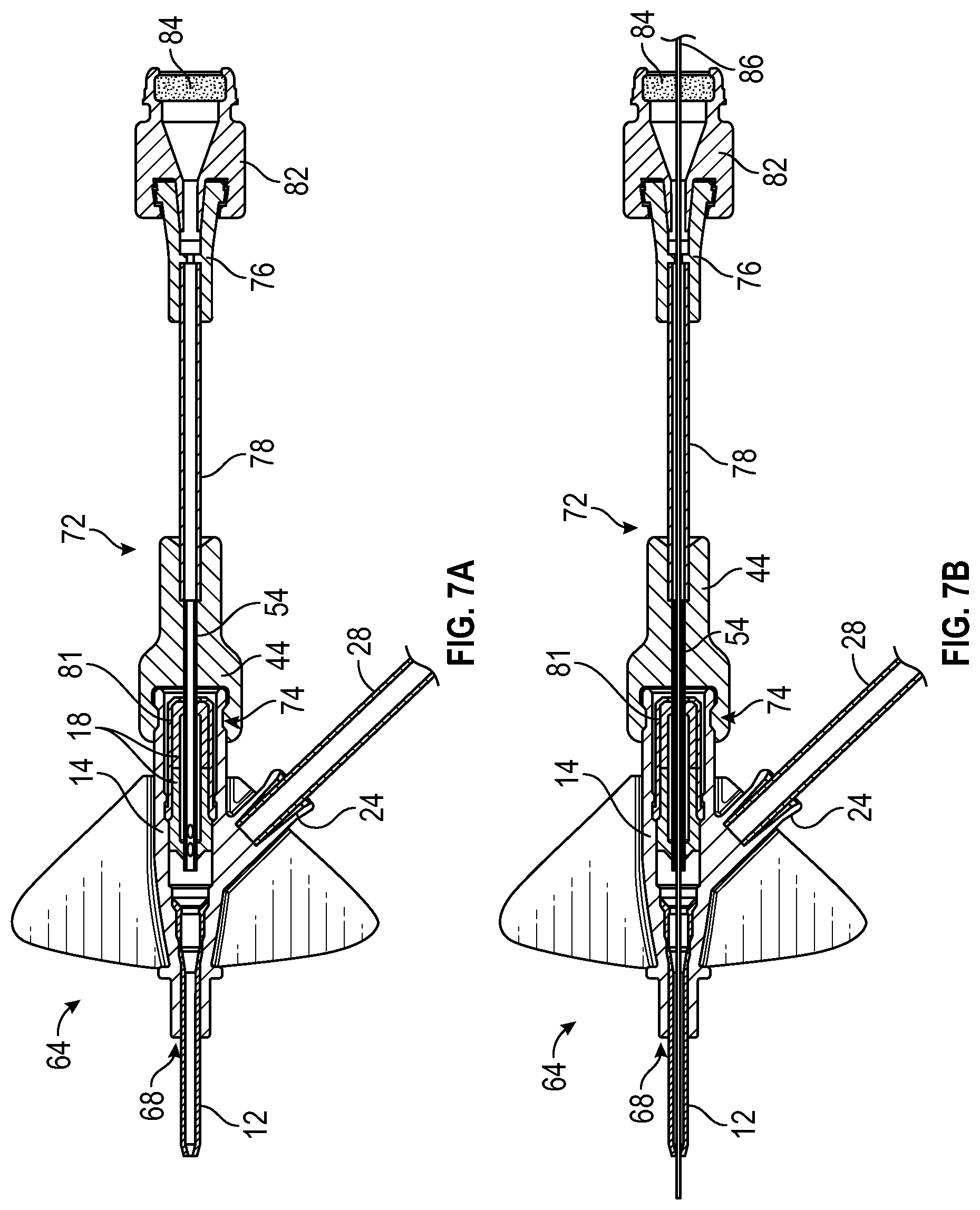 Patent US12097343 Figure 15 – Systems and methods to improve instrument guidance within an intravenous catheter assembly