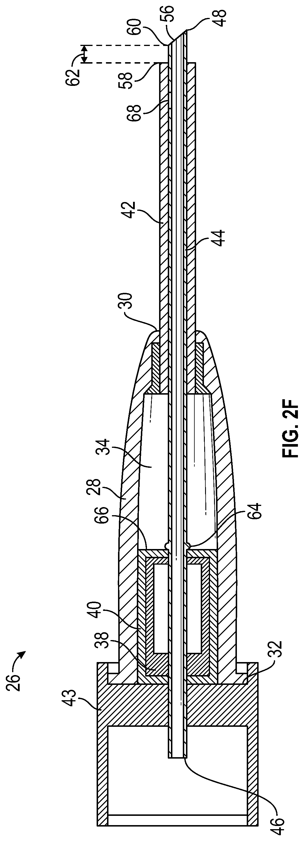 Patent US12097344 Figure 5 – Introducer needle having a bump and related systems and methods