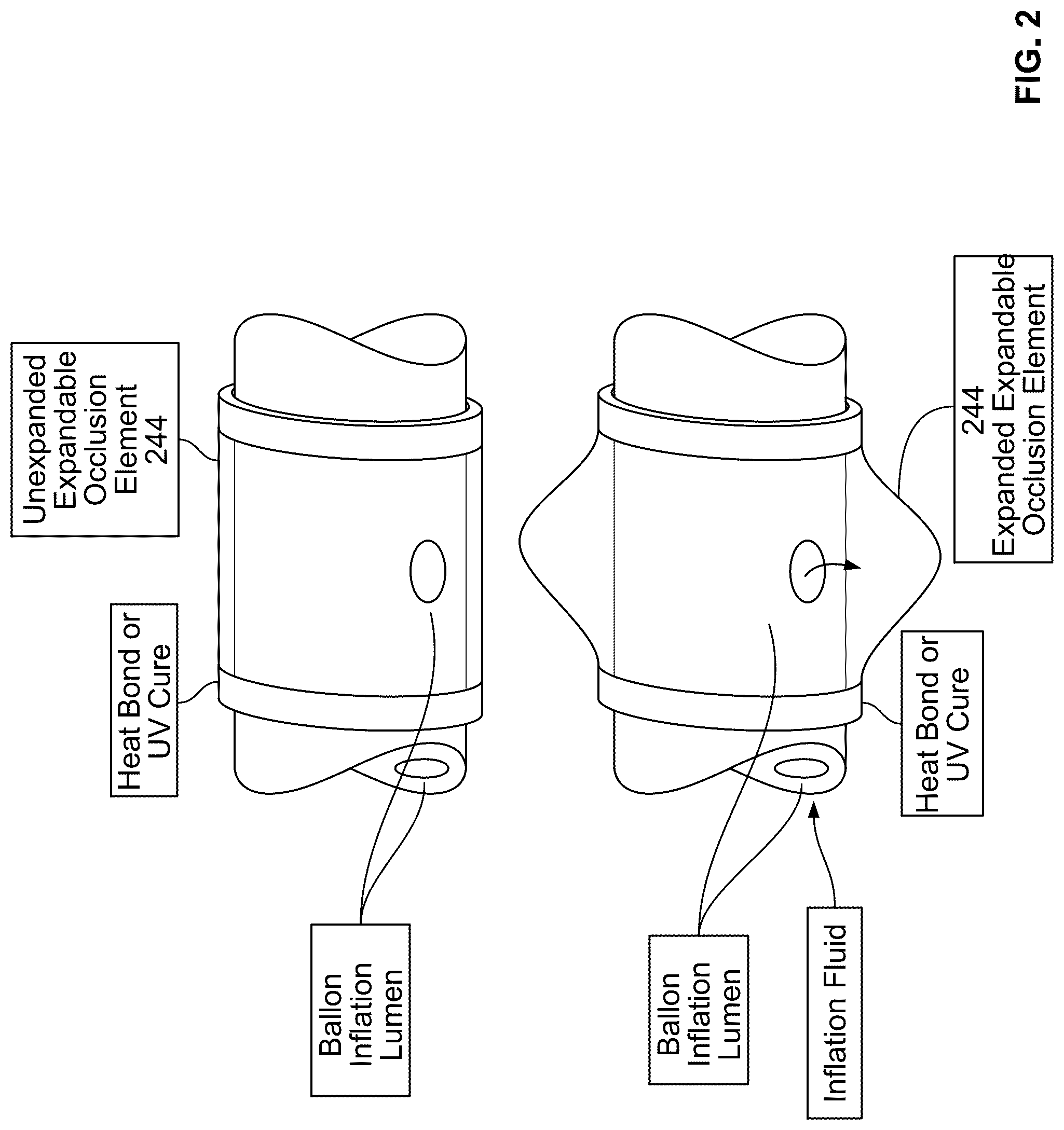 Patent US12097345 Figure 3 – Infusion catheter and methods of use