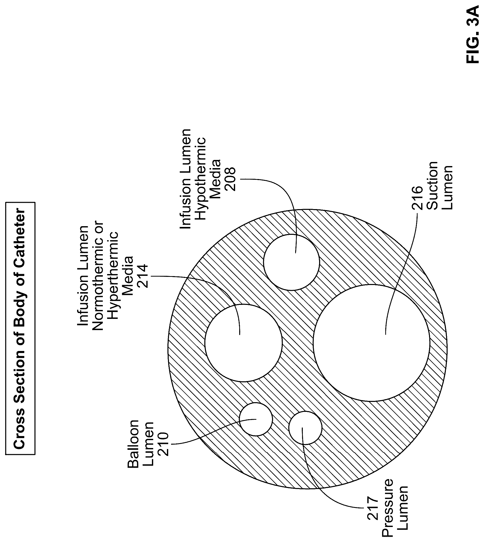 Patent US12097345 Figure 4 – Infusion catheter and methods of use